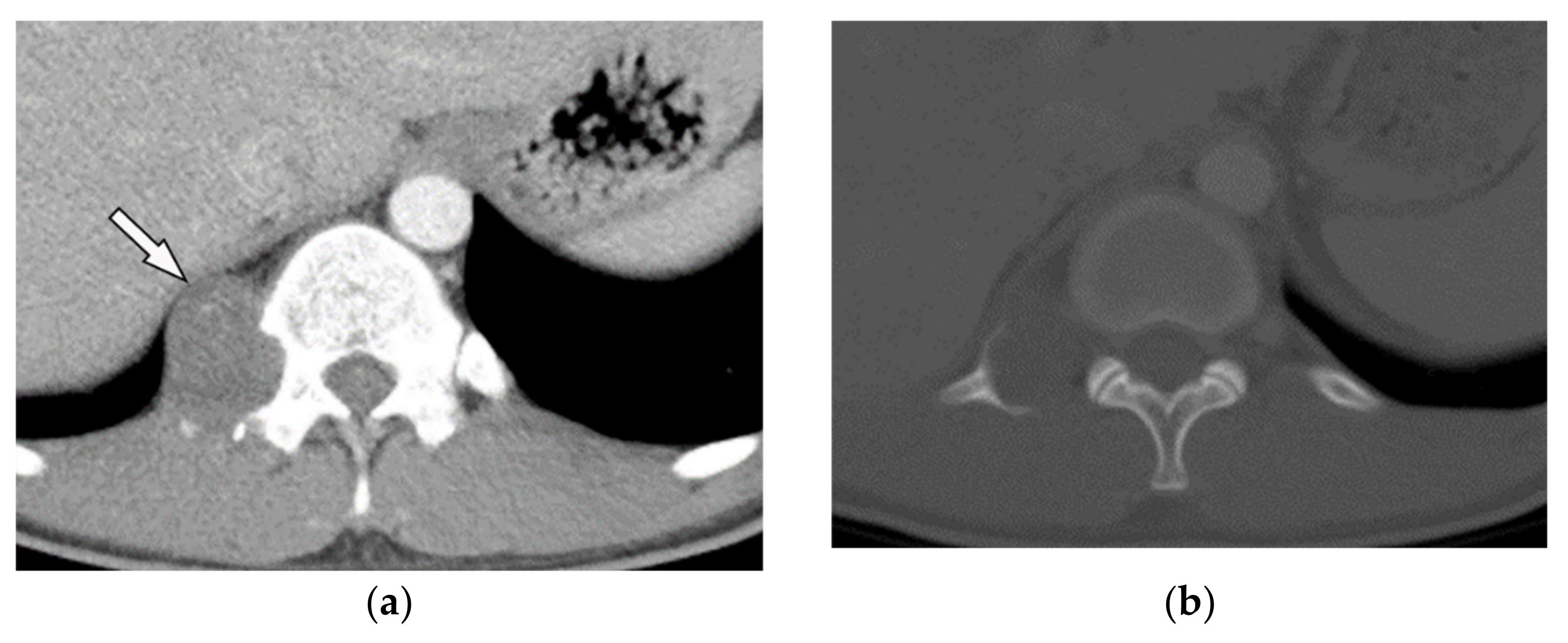 Diagnostics 12 00301 g010a Diagnostics 12 00301 g010a