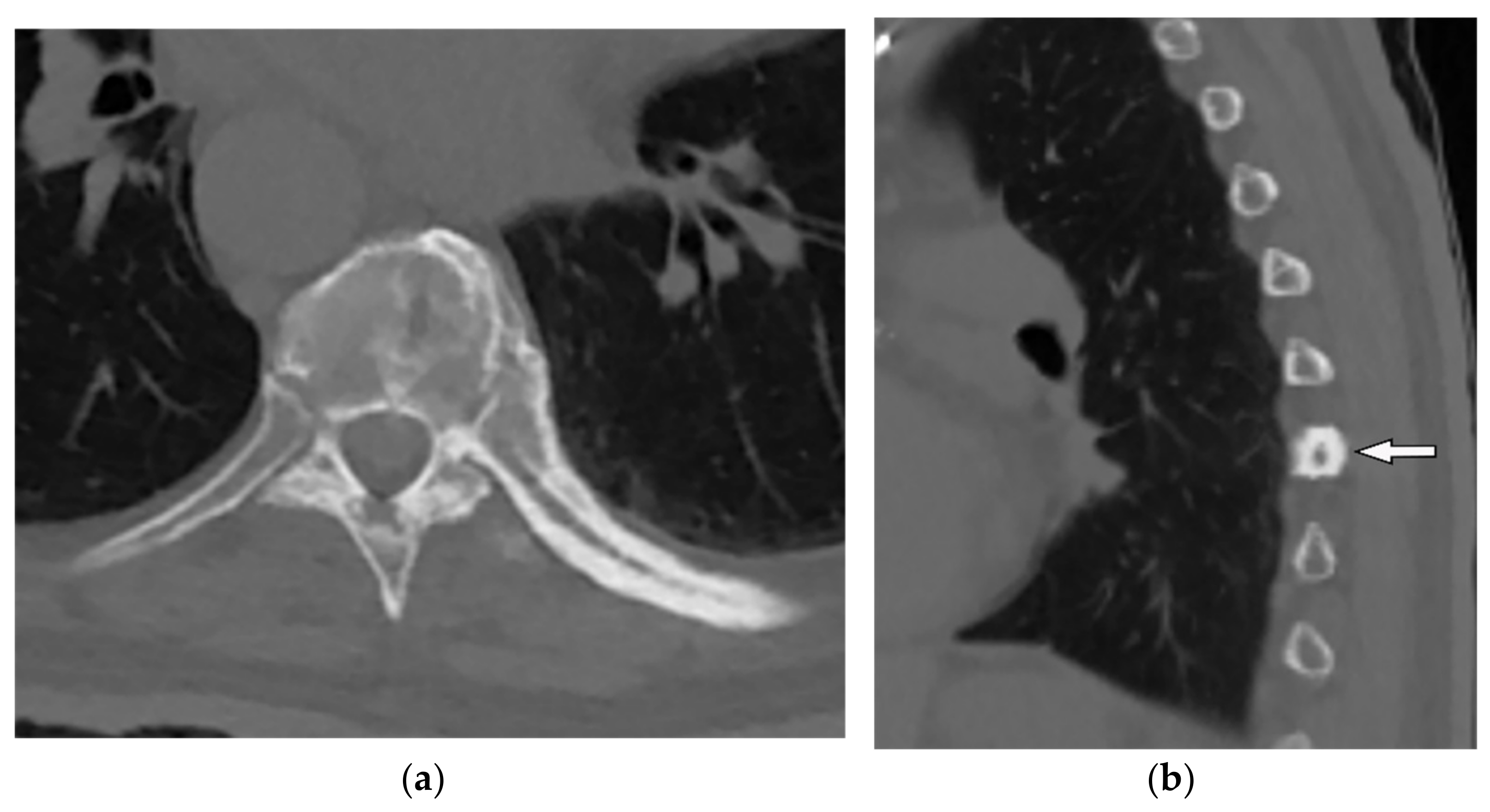 Diagnostics 12 00301 g011 Diagnostics 12 00301 g011
