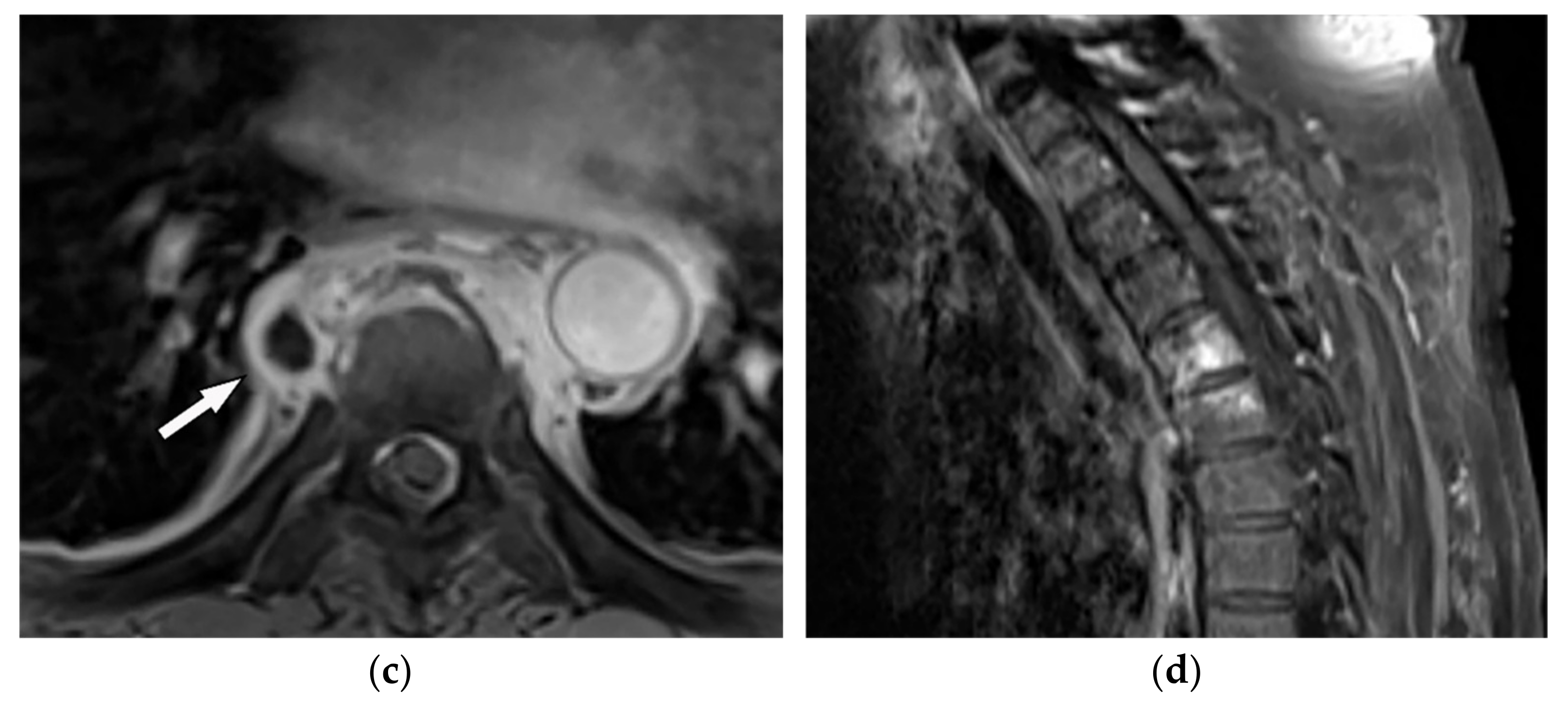 Diagnostics 12 00301 g012b Diagnostics 12 00301 g012b