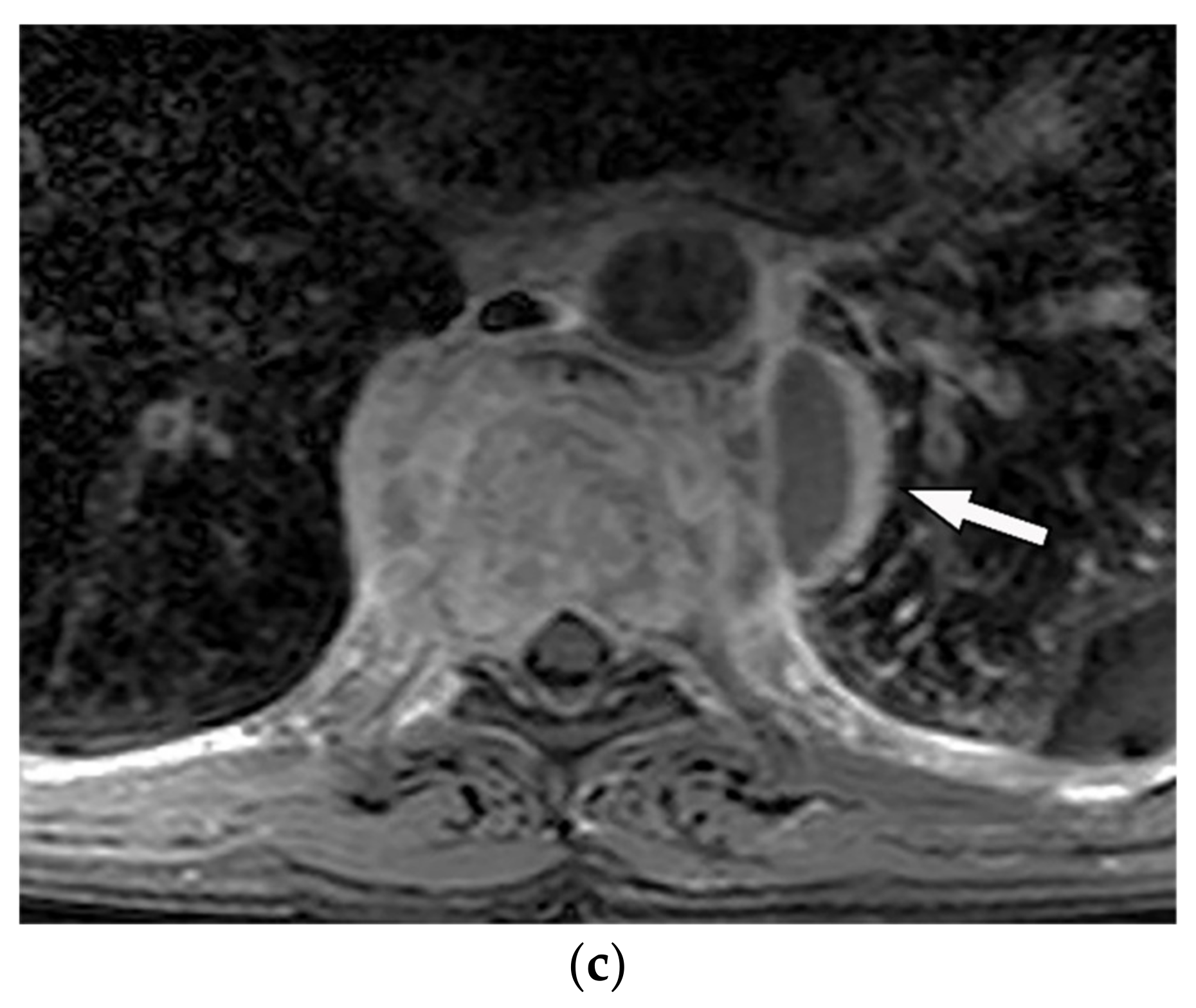 Diagnostics 12 00301 g013b Diagnostics 12 00301 g013b