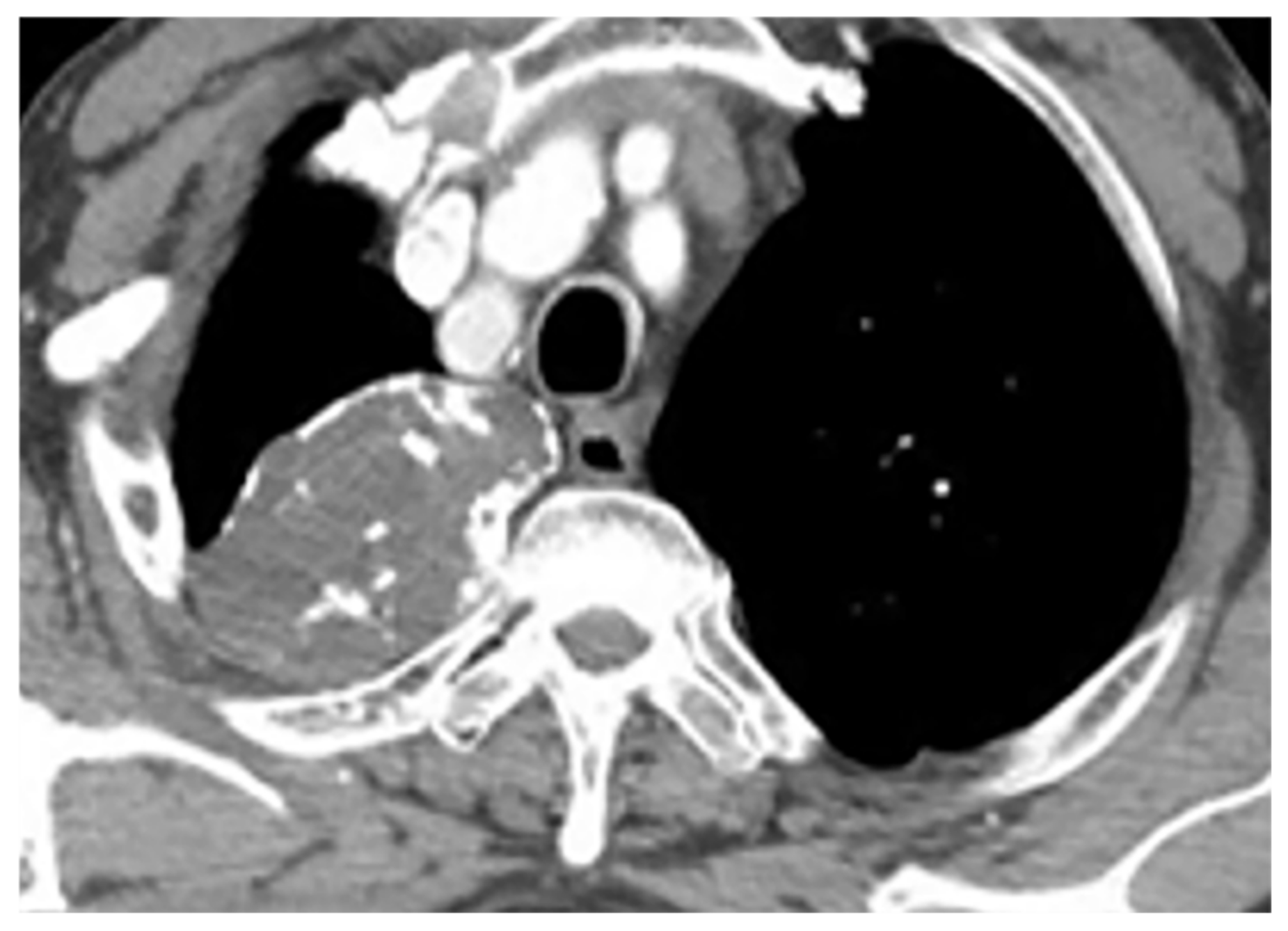 Diagnostics 12 00301 g014 Diagnostics 12 00301 g014