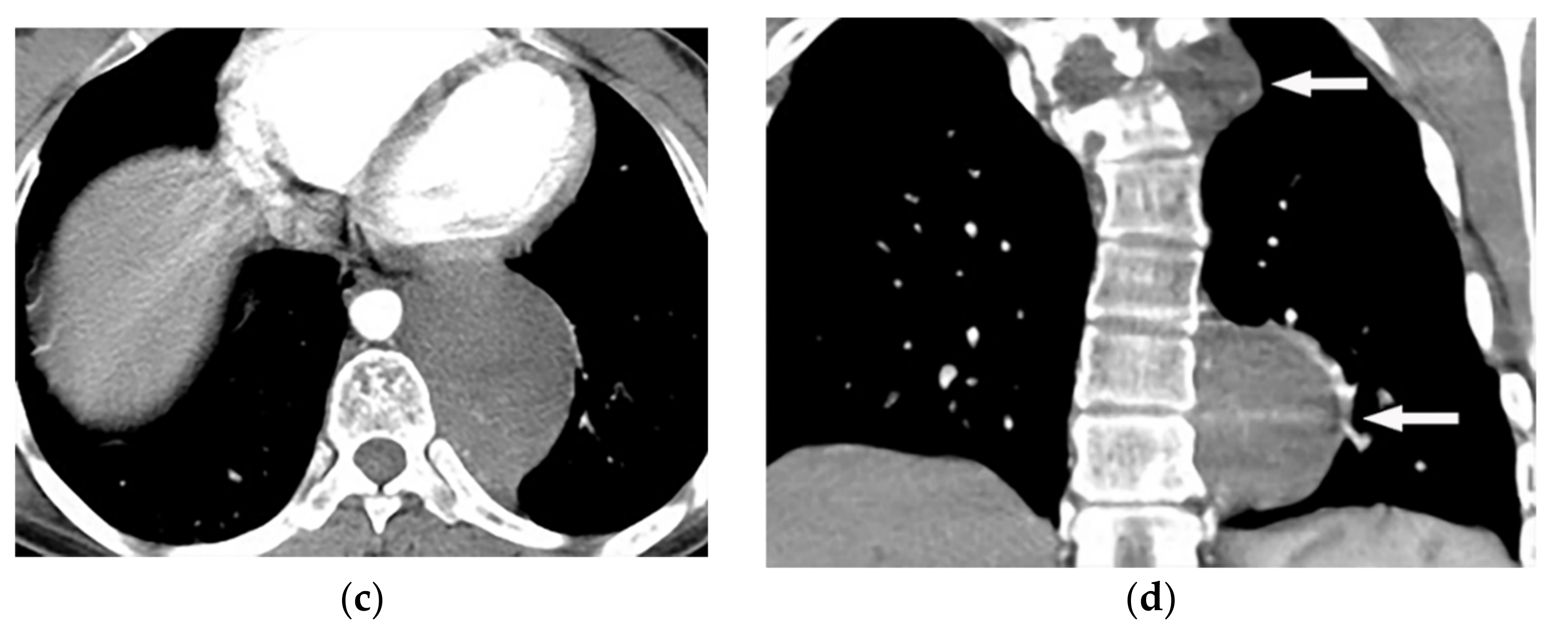 Diagnostics 12 00301 g015b Diagnostics 12 00301 g015b