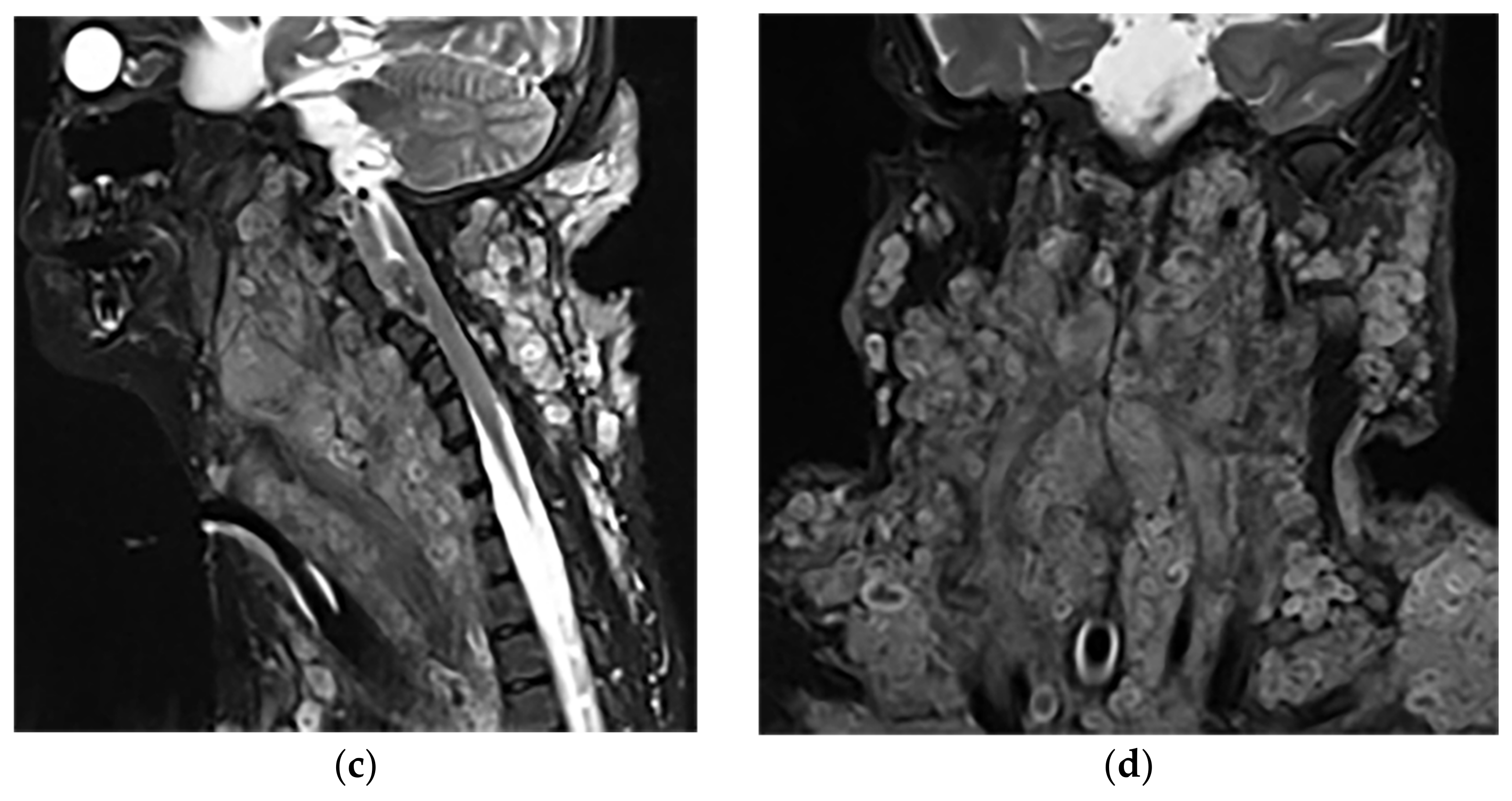 Diagnostics 12 00301 g017b Diagnostics 12 00301 g017b