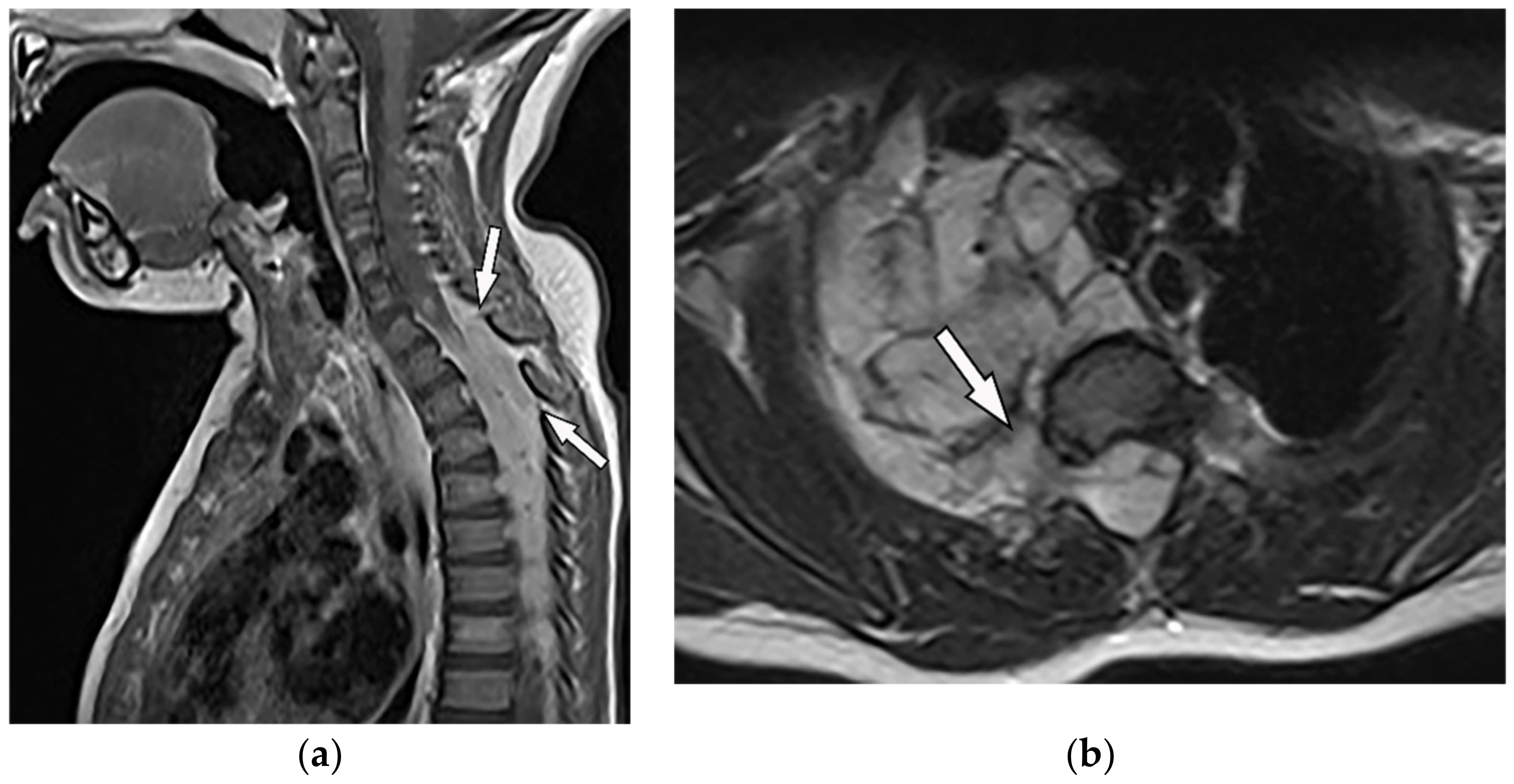 Diagnostics 12 00301 g018 Diagnostics 12 00301 g018