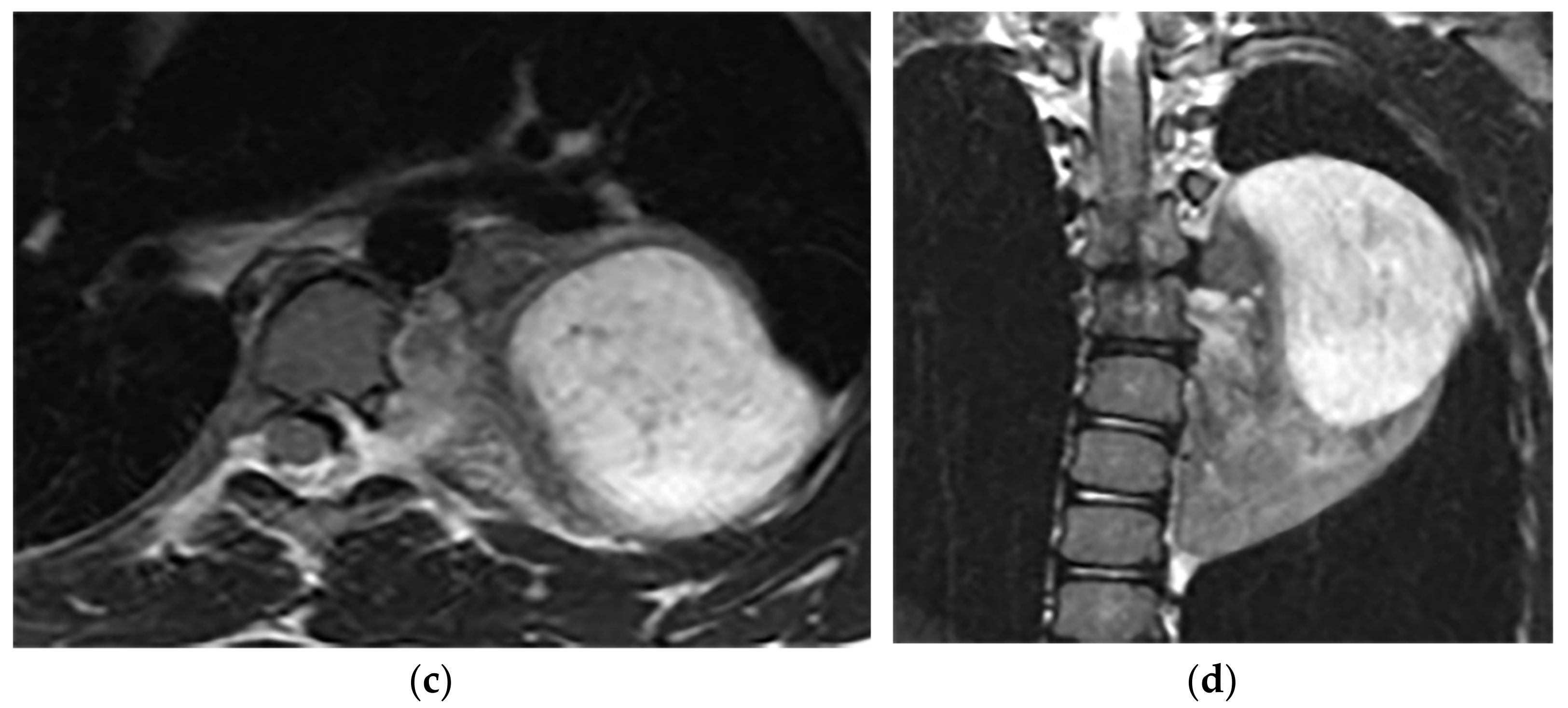Diagnostics 12 00301 g020b Diagnostics 12 00301 g020b