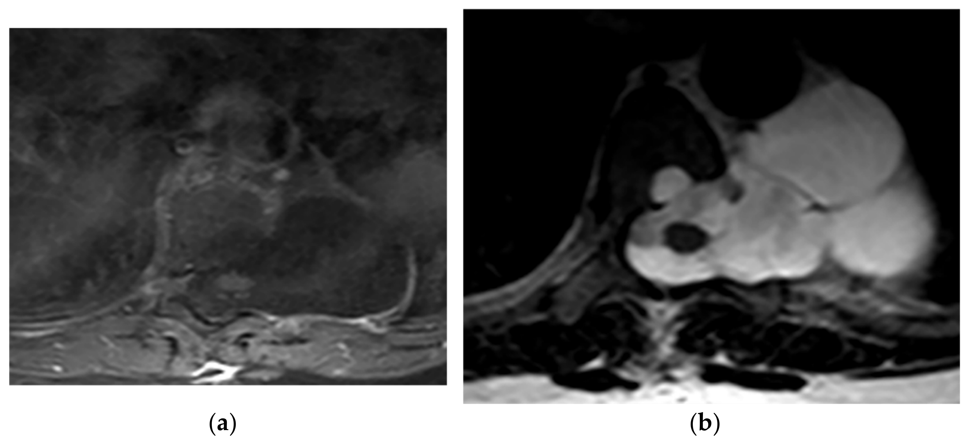 Diagnostics 12 00301 g021 Diagnostics 12 00301 g021