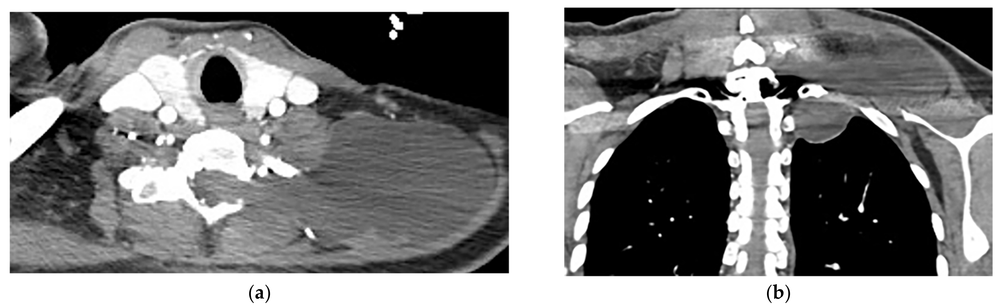 Diagnostics 12 00301 g022 Diagnostics 12 00301 g022
