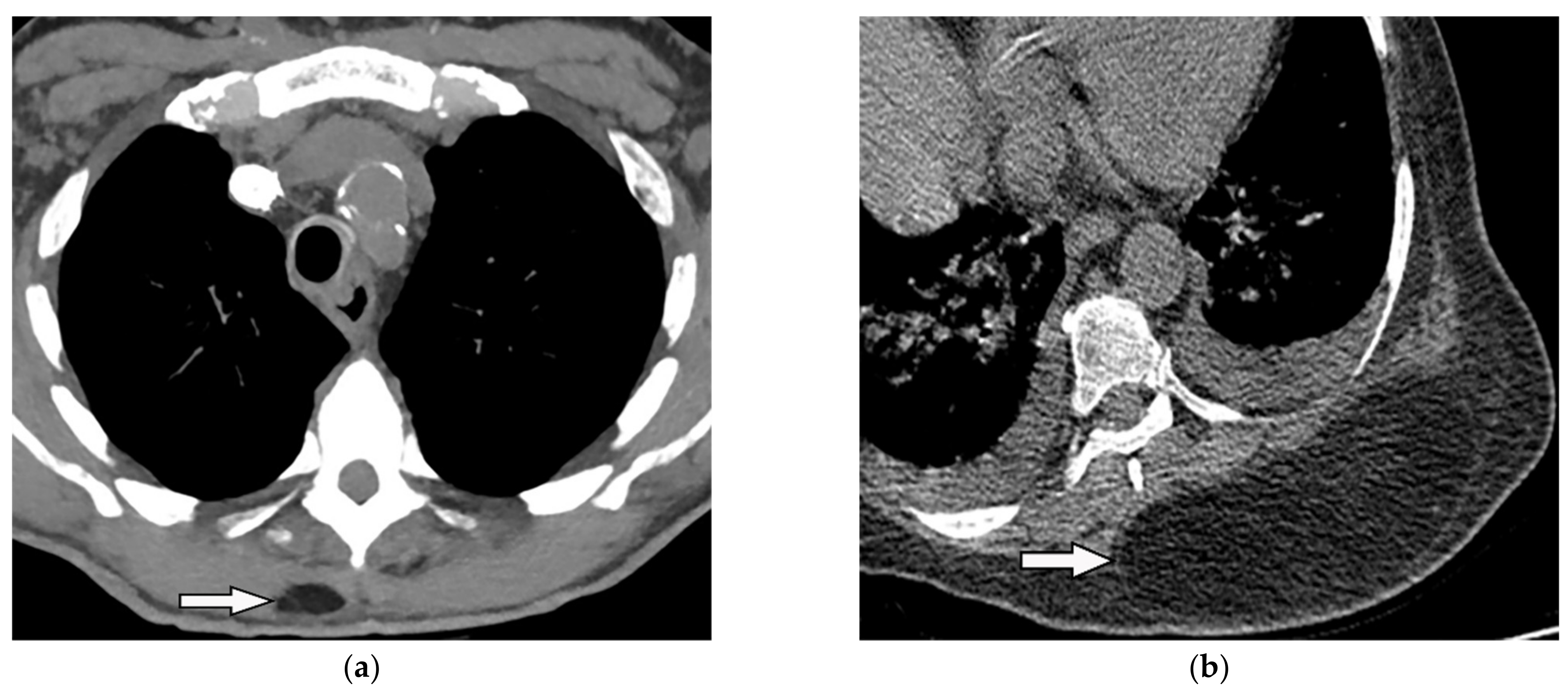Diagnostics 12 00301 g023 Diagnostics 12 00301 g023