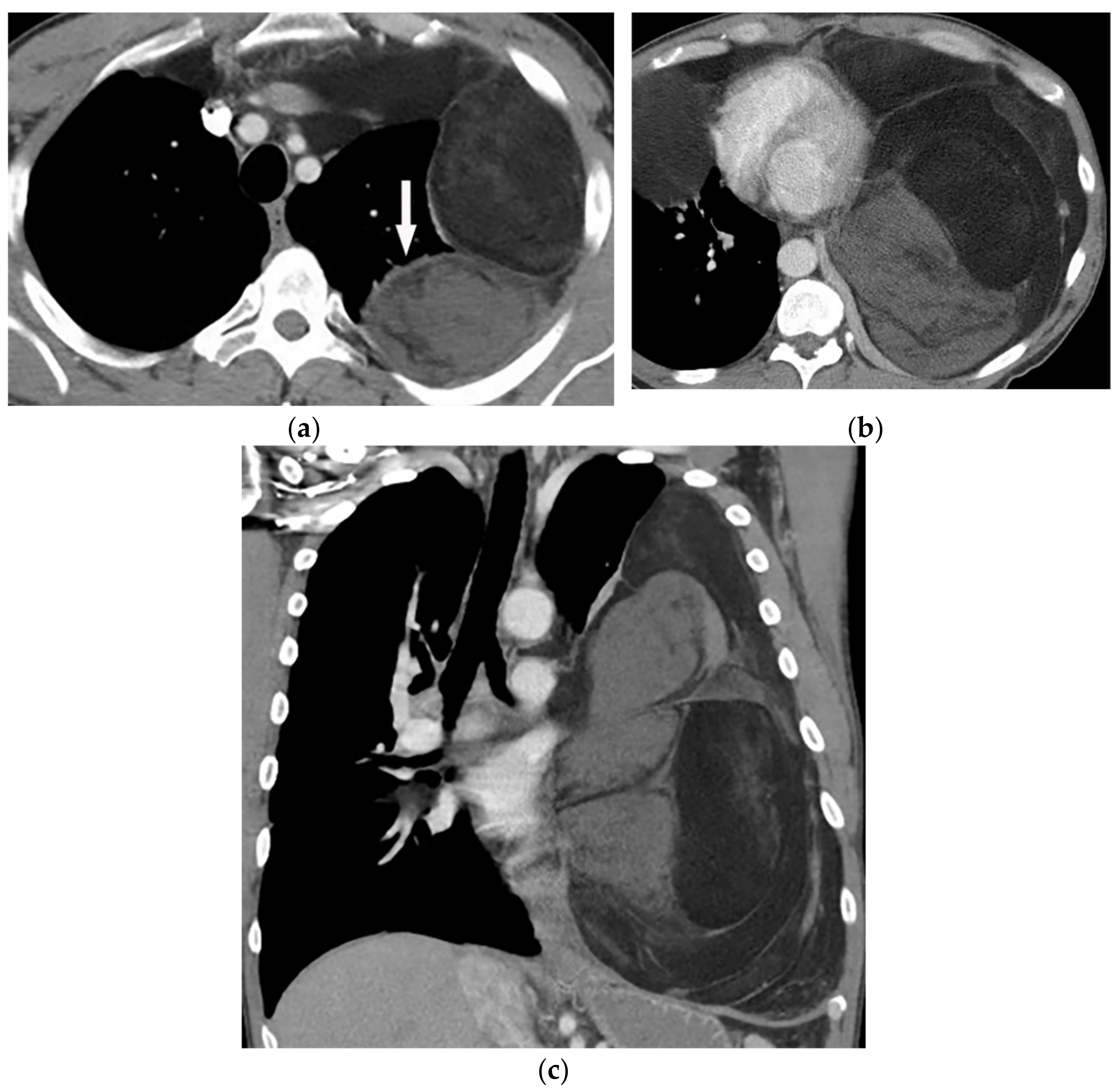 Diagnostics 12 00301 g024 Diagnostics 12 00301 g024