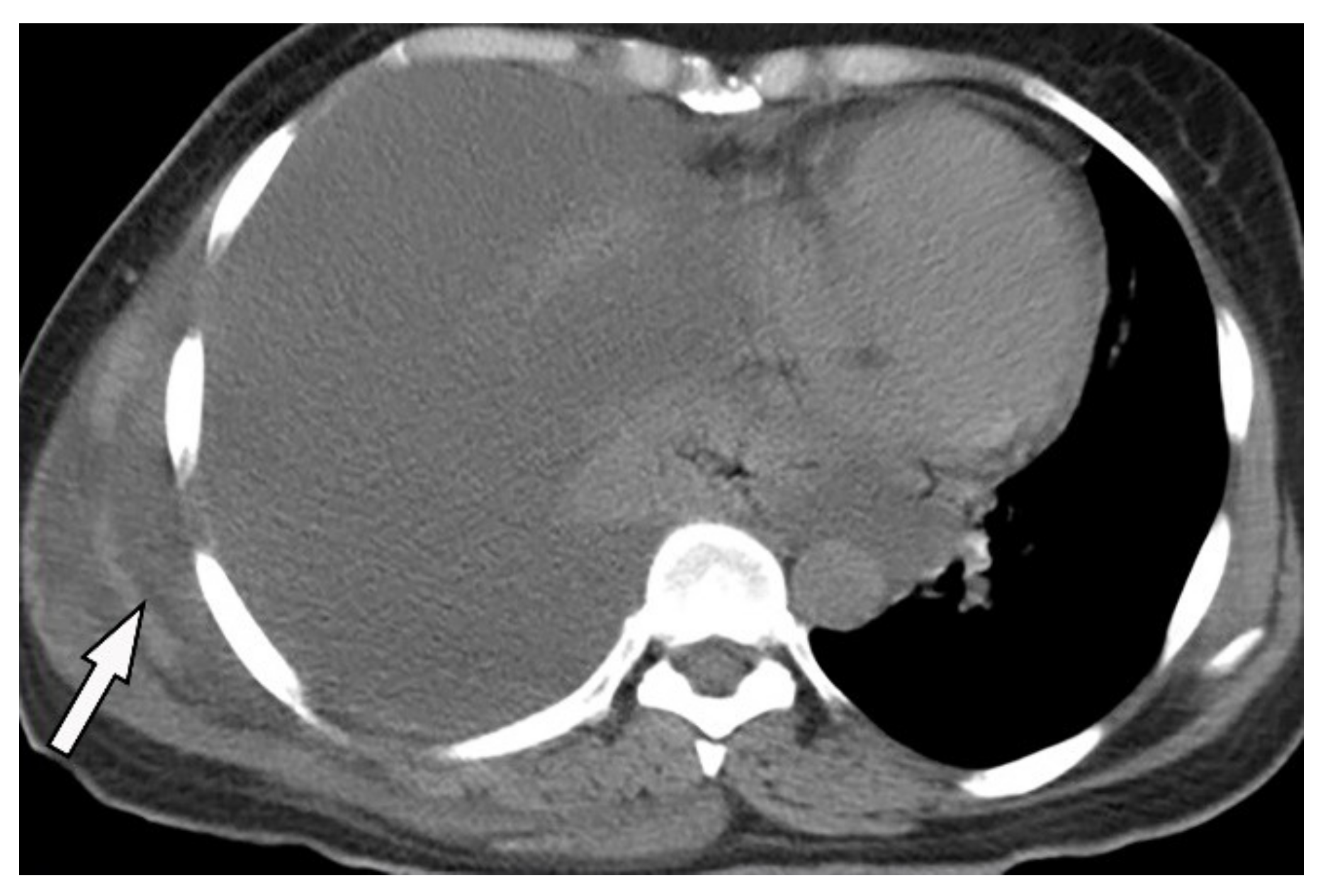 Diagnostics 12 00301 g025 Diagnostics 12 00301 g025