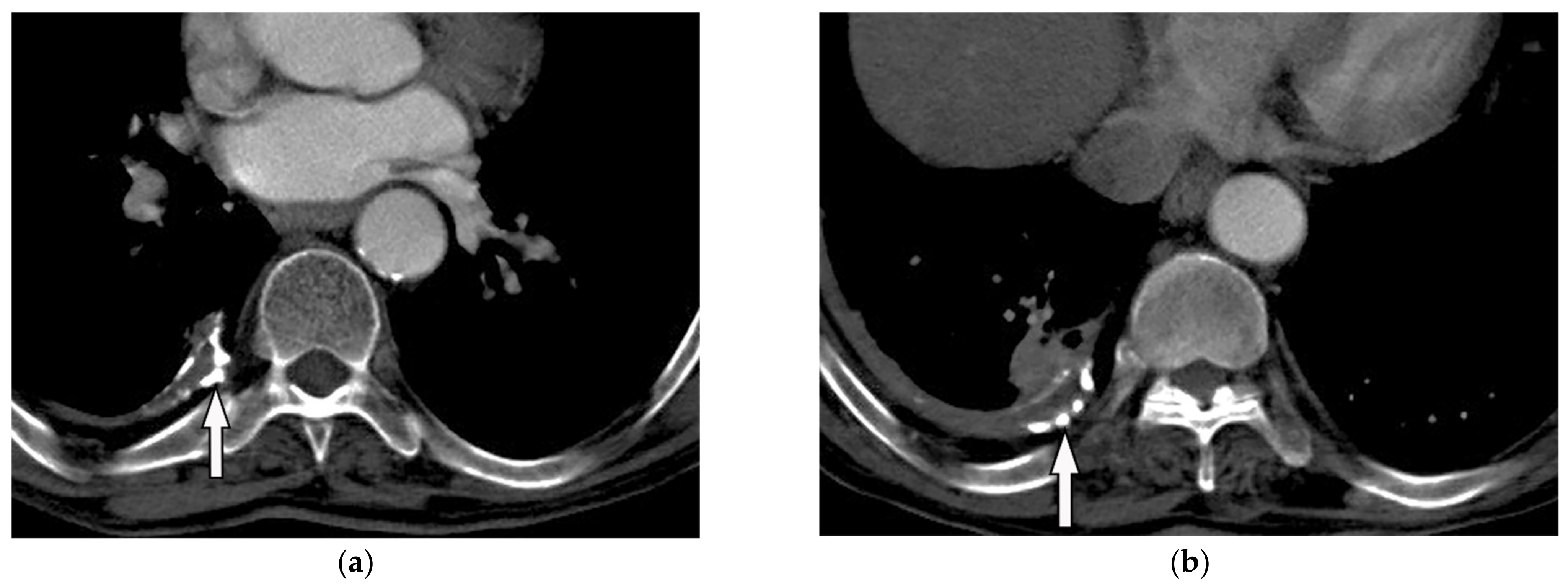 Diagnostics 12 00301 g026 Diagnostics 12 00301 g026