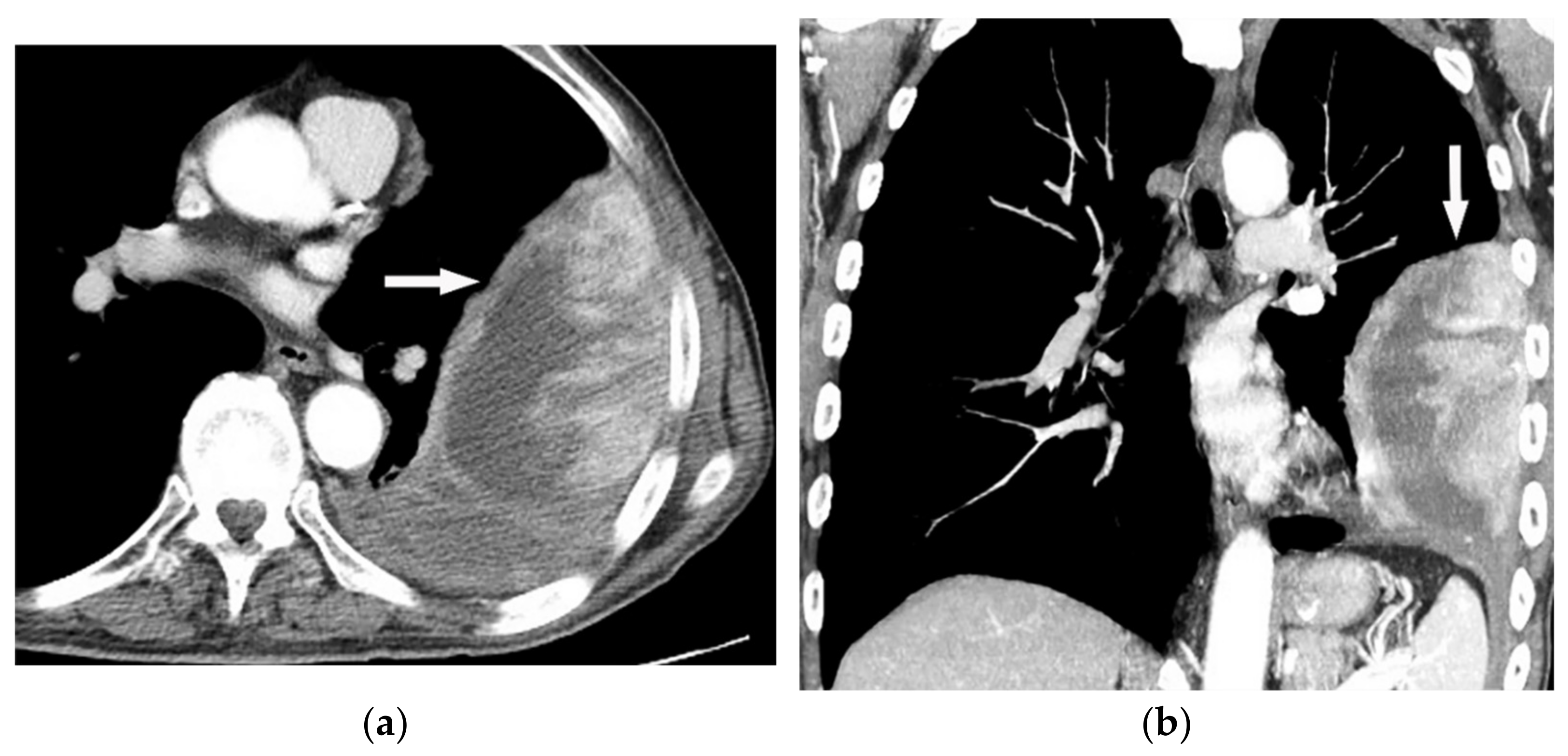 Diagnostics 12 00301 g027 Diagnostics 12 00301 g027