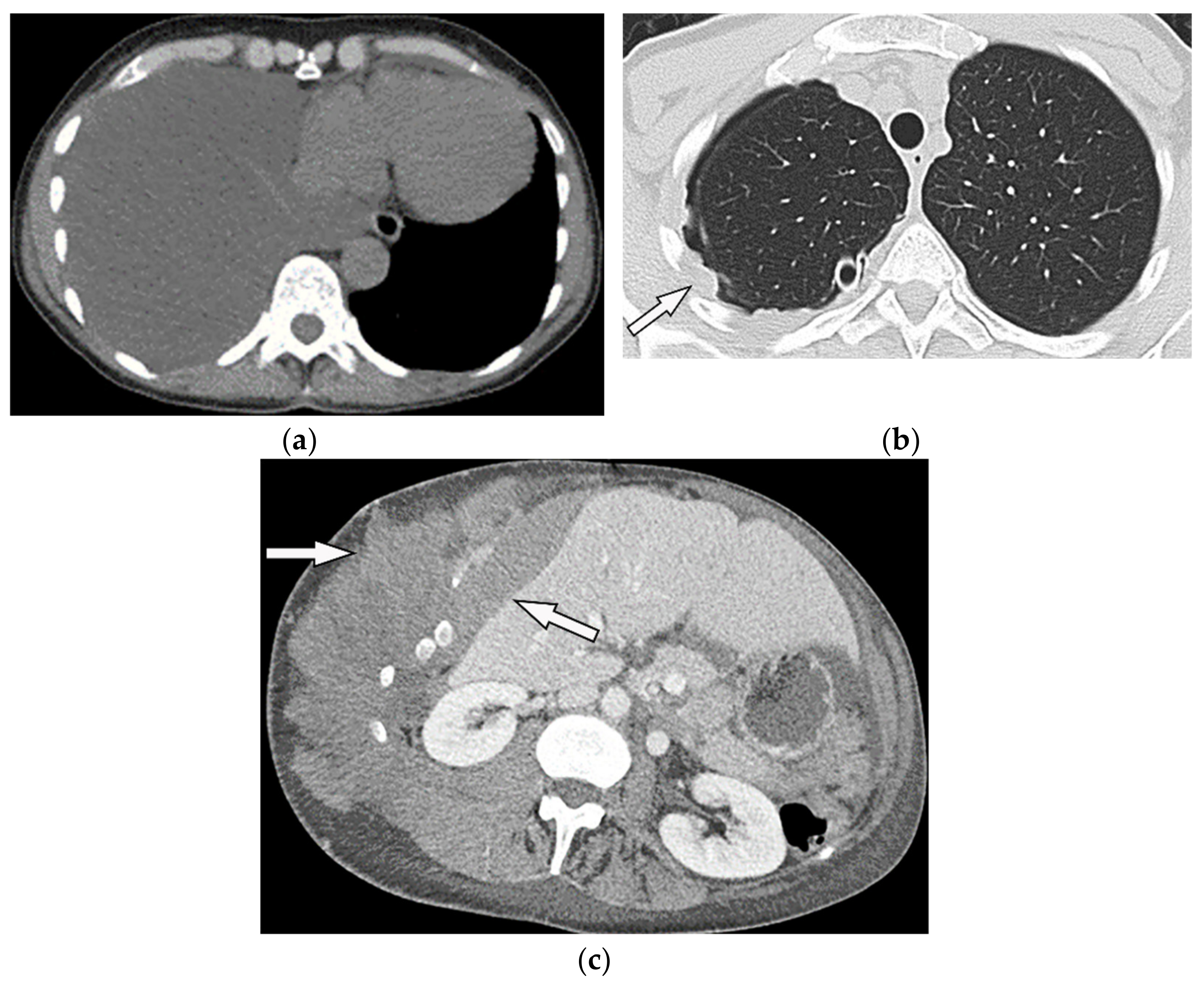 Diagnostics 12 00301 g028 Diagnostics 12 00301 g028
