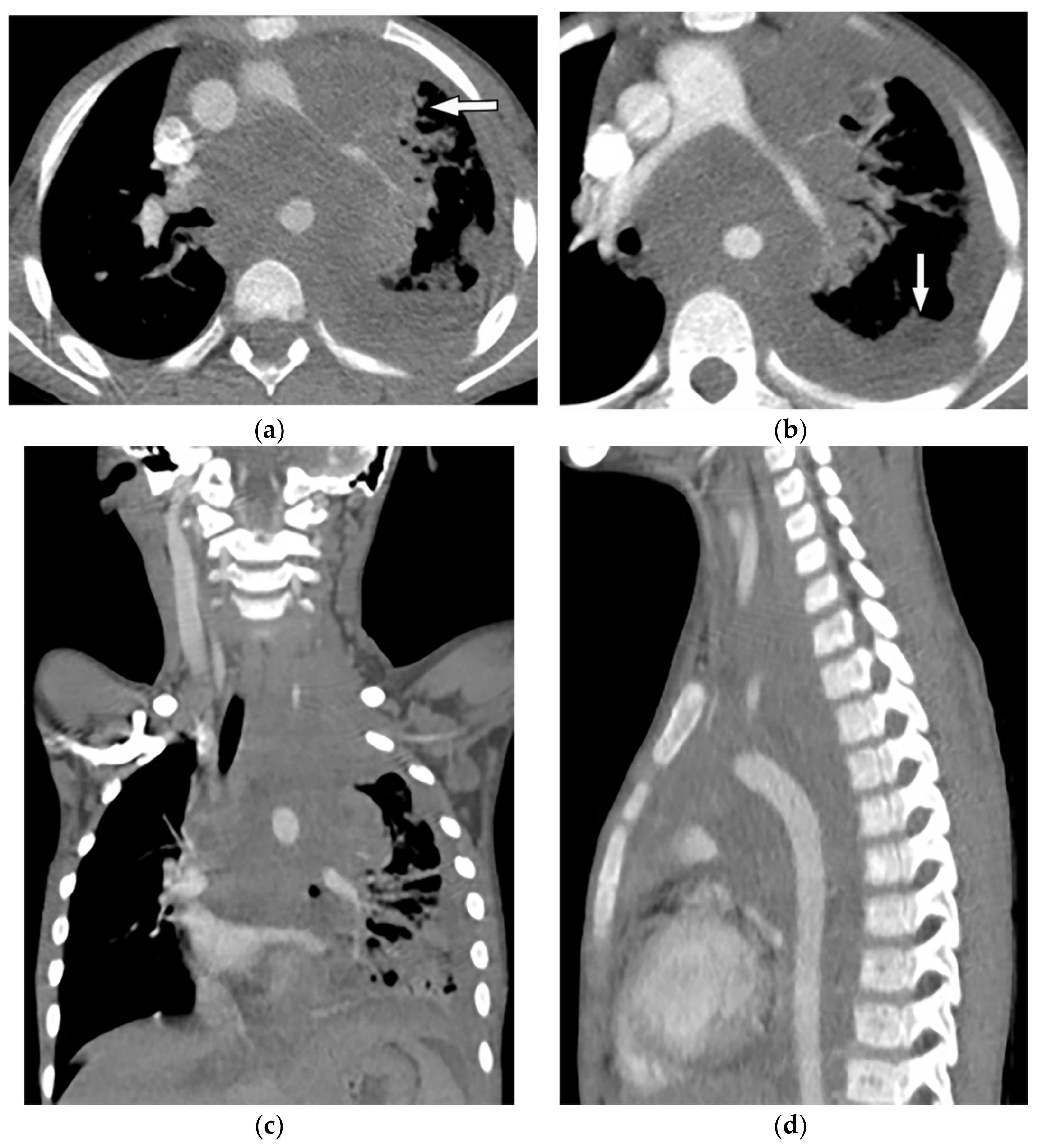 Diagnostics 12 00301 g029 Diagnostics 12 00301 g029