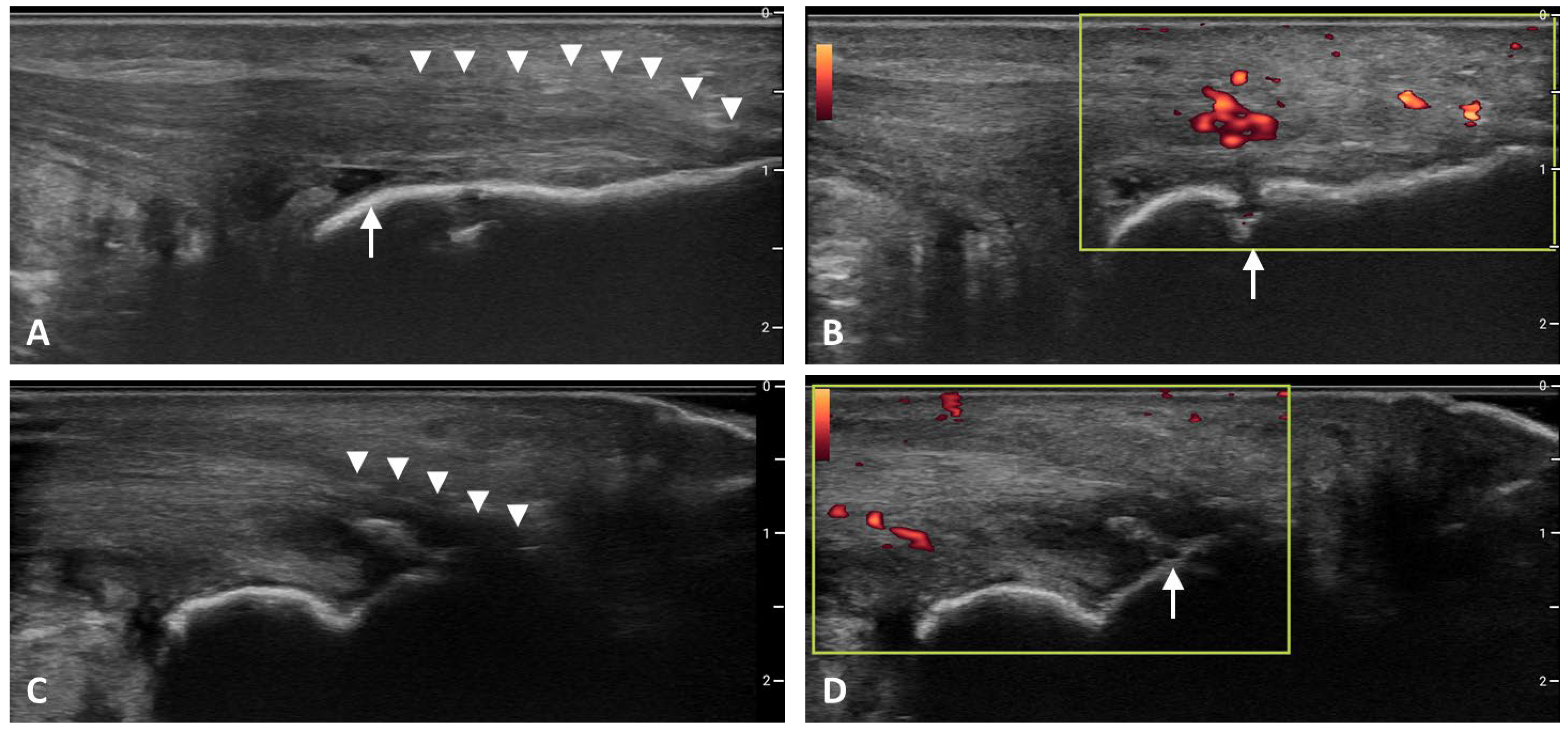 Diagnostics 12 00303 g002 550