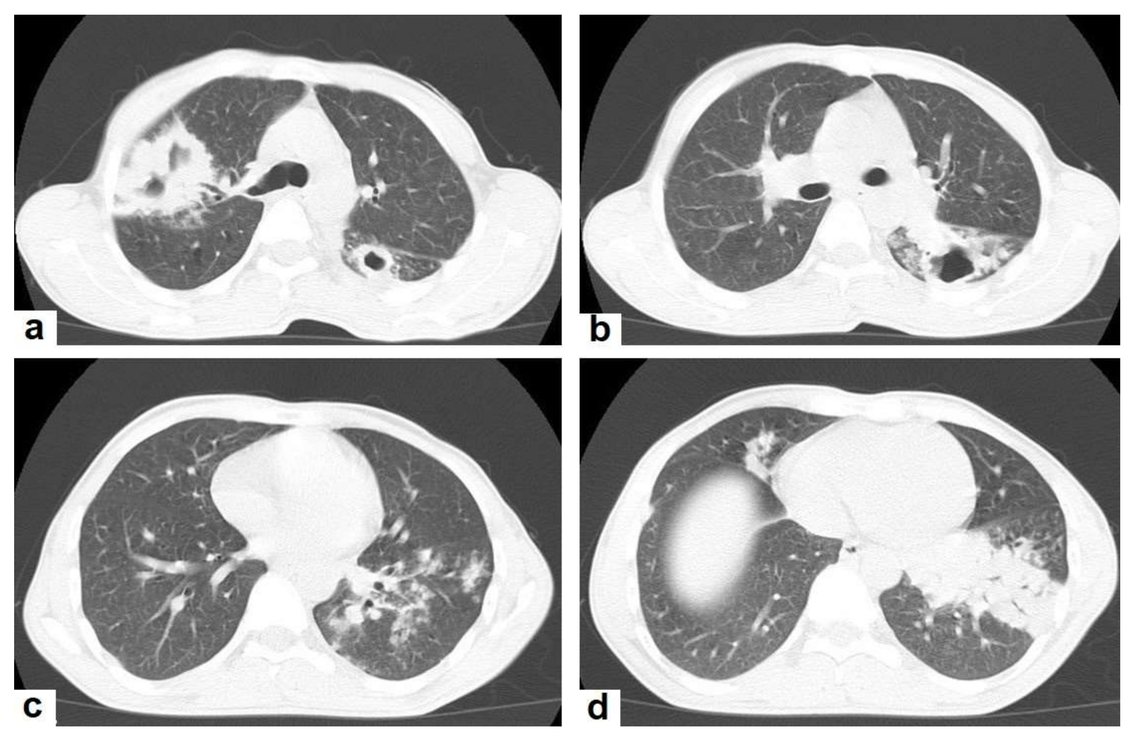 Diagnostics 12 00306 g003 550