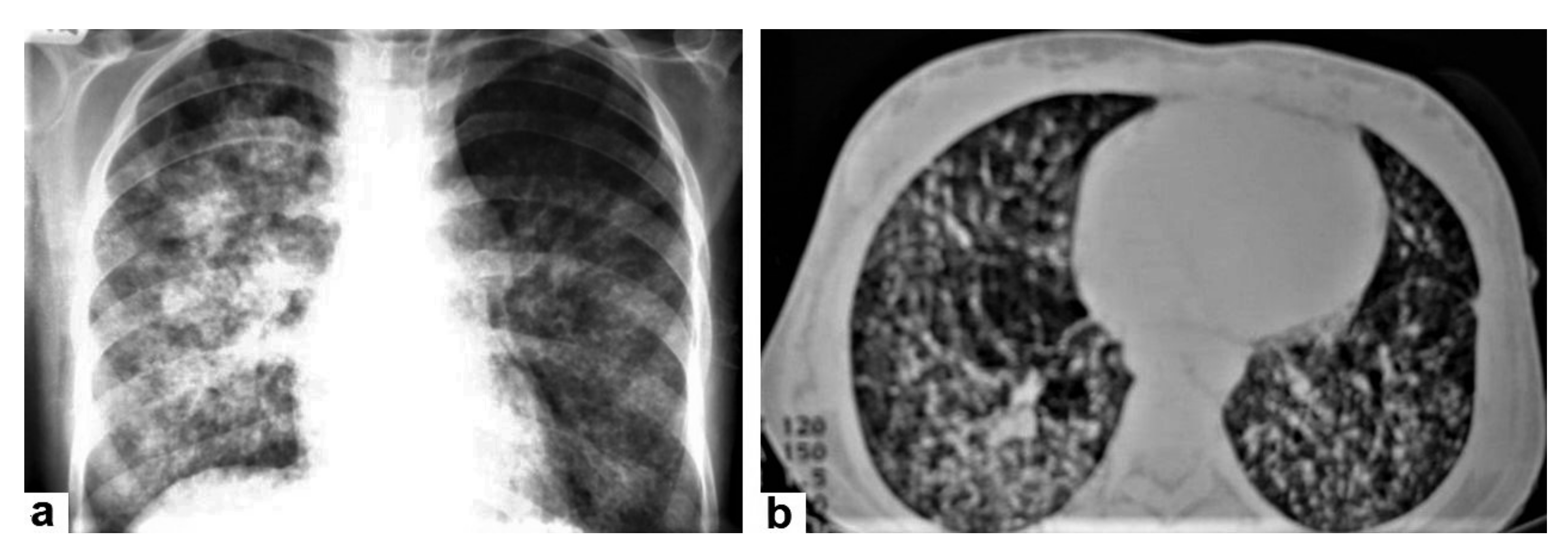Diagnostics 12 00306 g006 550