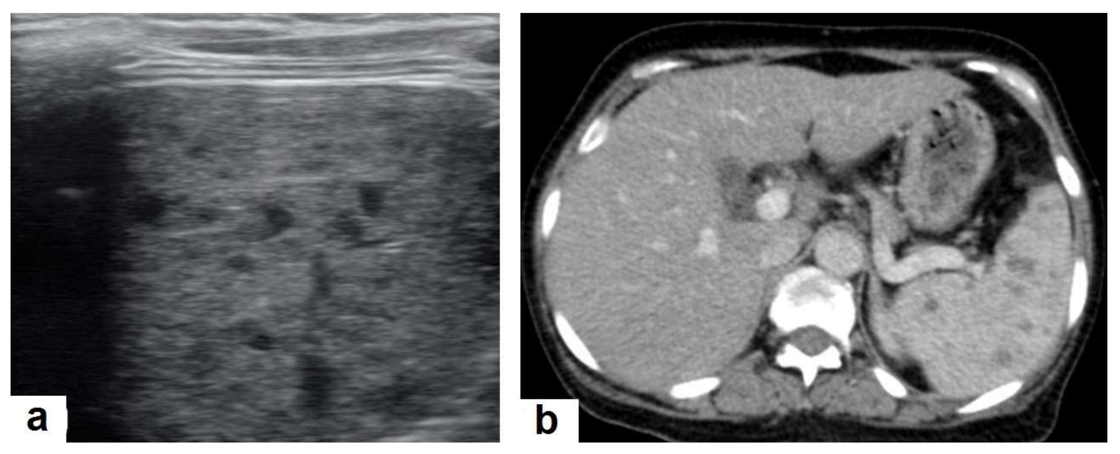 Diagnostics 12 00306 g007 550