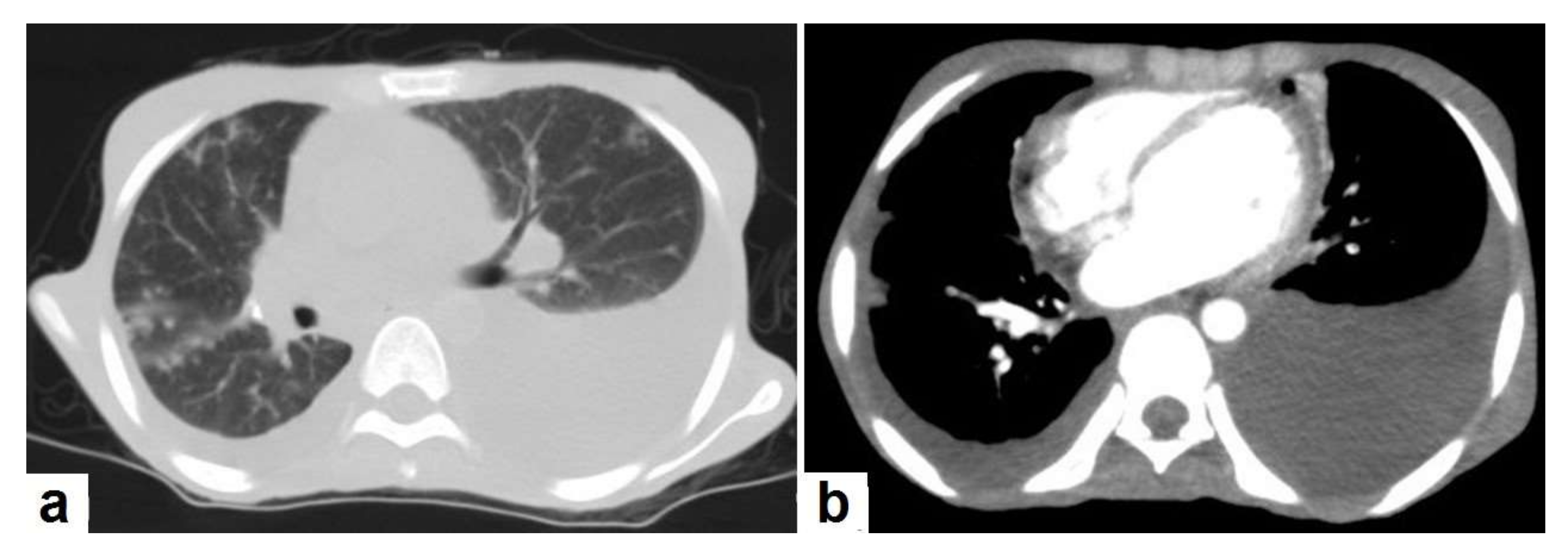 Diagnostics 12 00306 g008 550