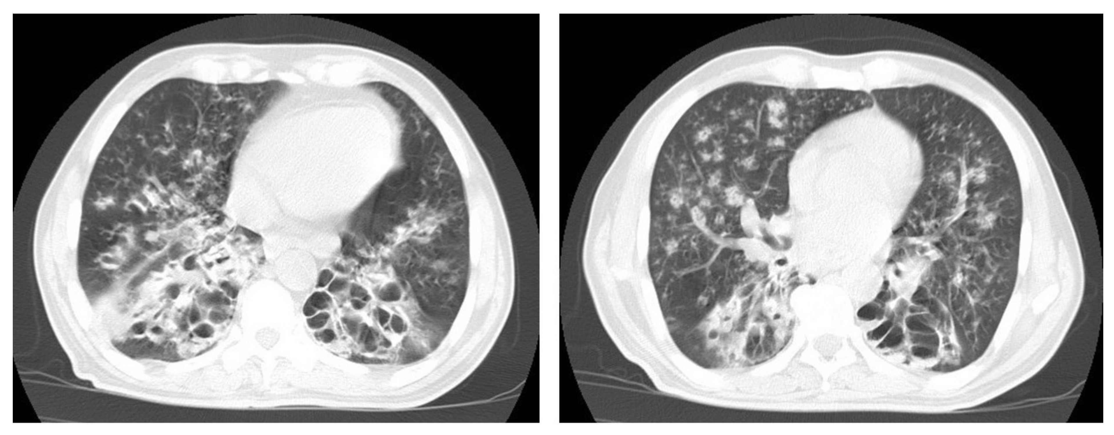 Diagnostics 12 00306 g010 550