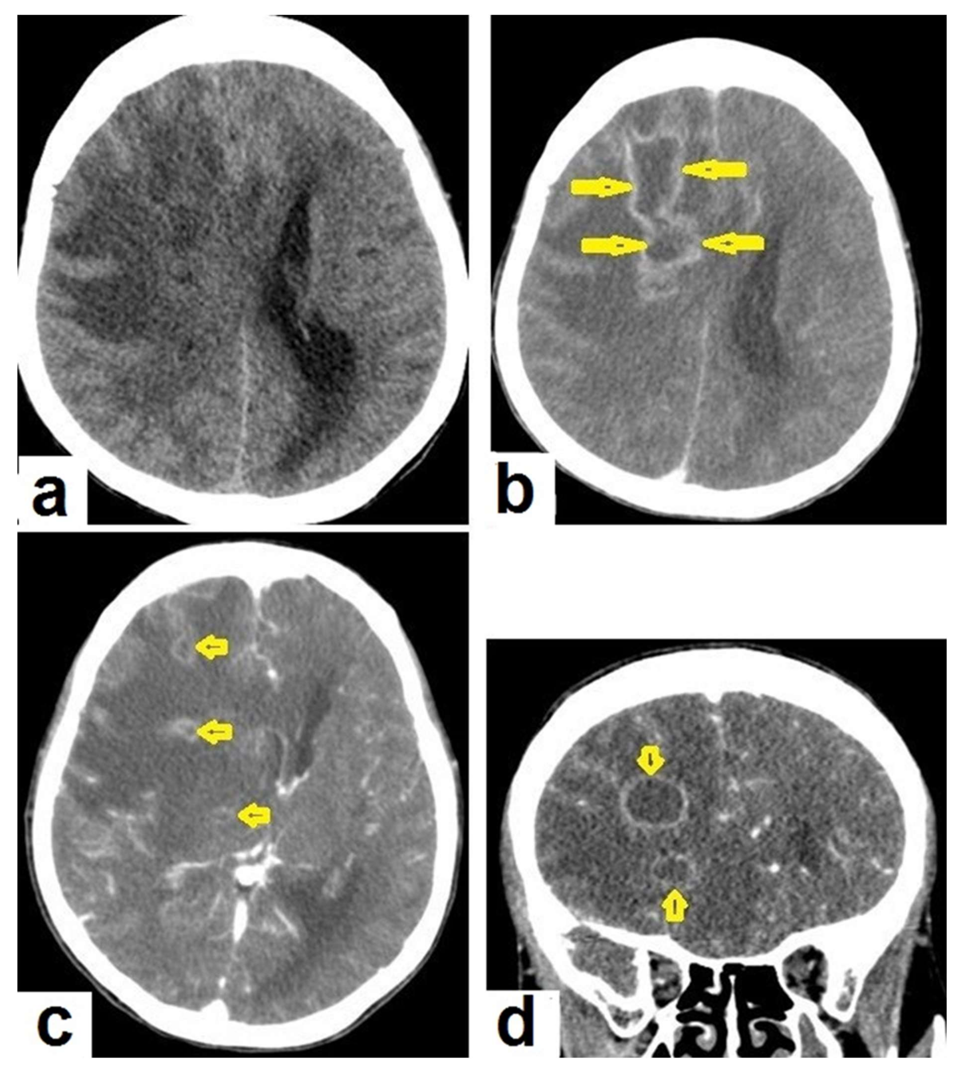 Diagnostics 12 00306 g015 550
