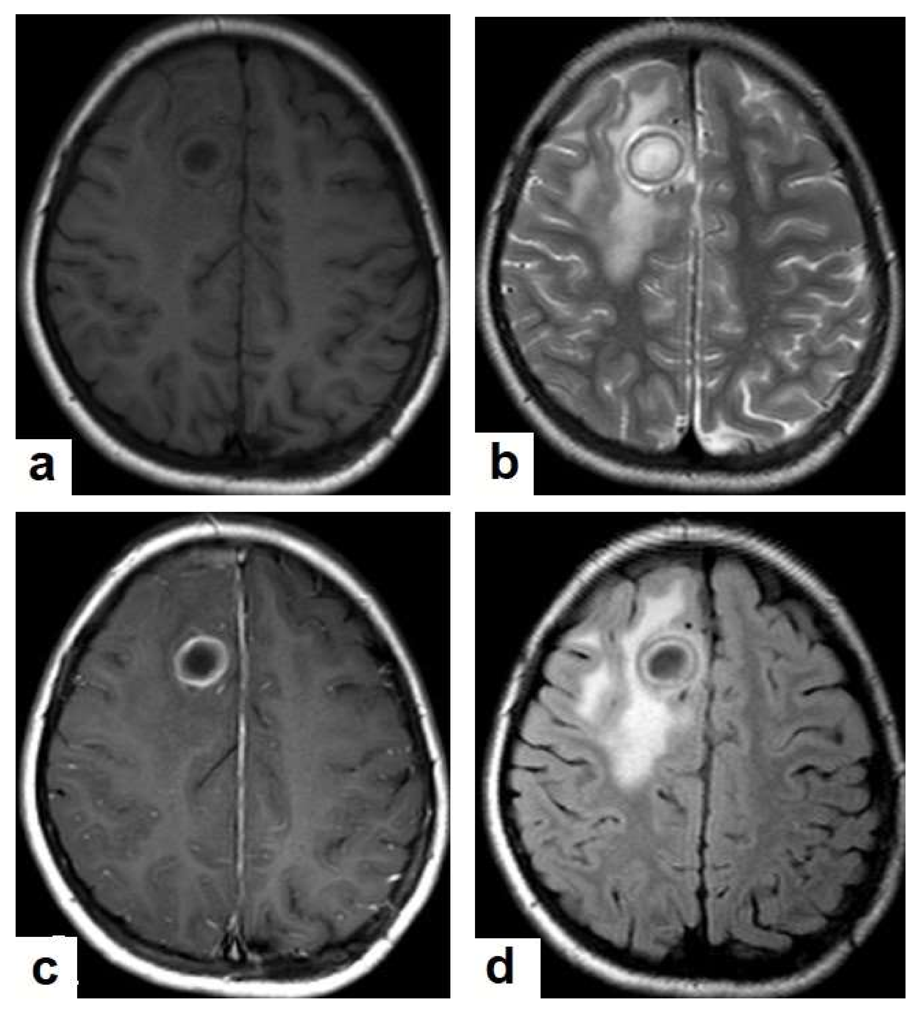Diagnostics 12 00306 g016 550