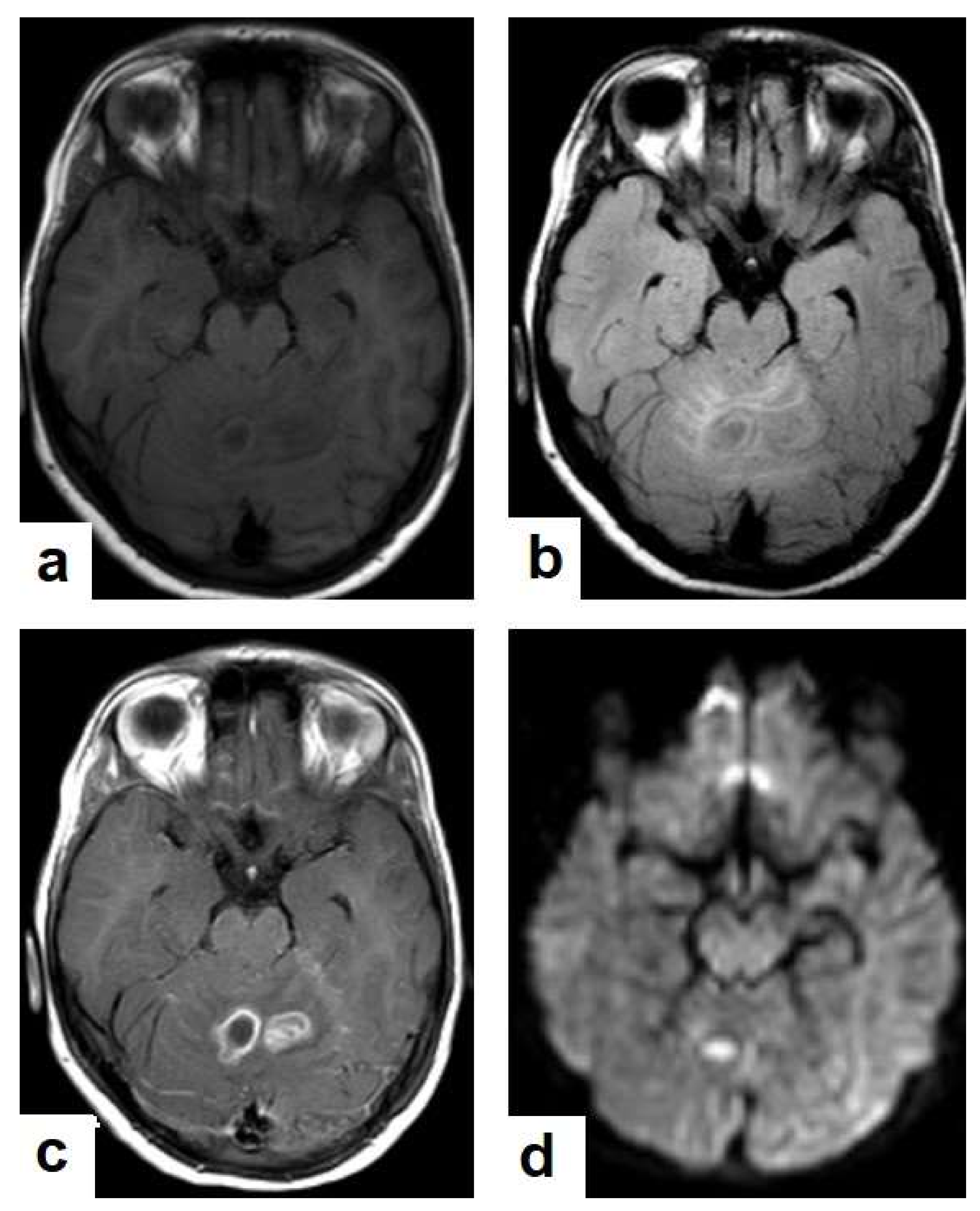 Diagnostics 12 00306 g017 550