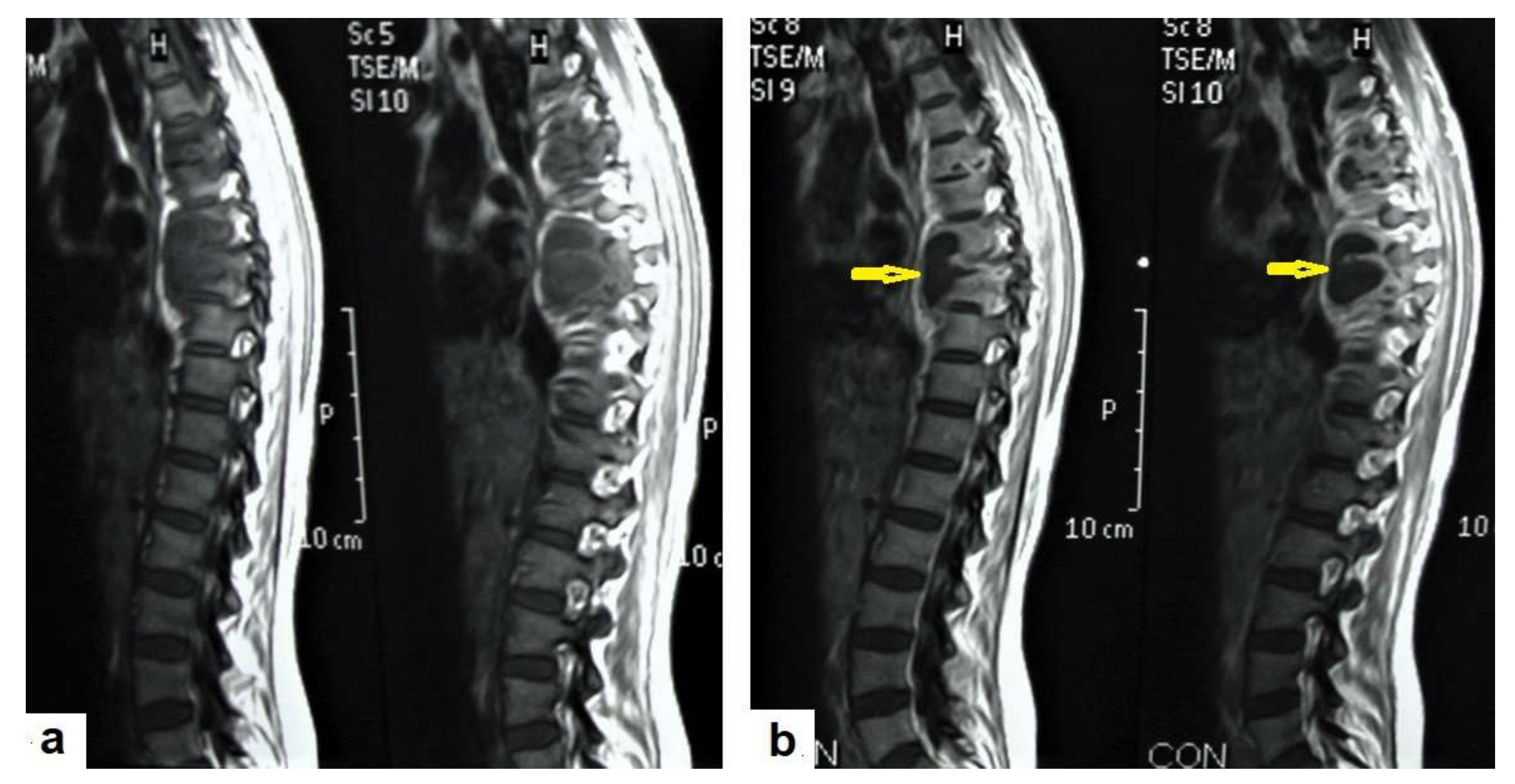 Diagnostics 12 00306 g018 550