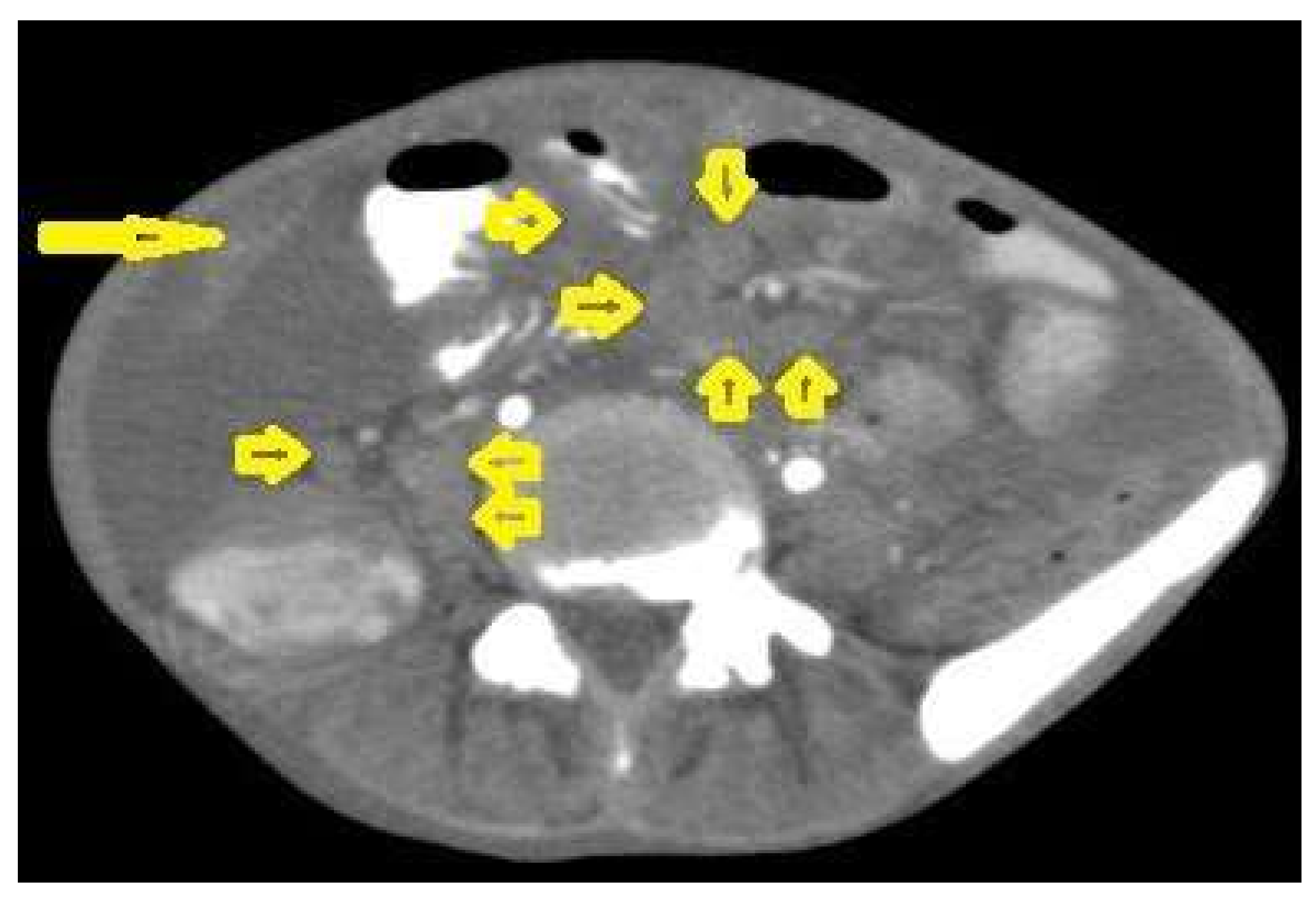 Diagnostics 12 00306 g020 550