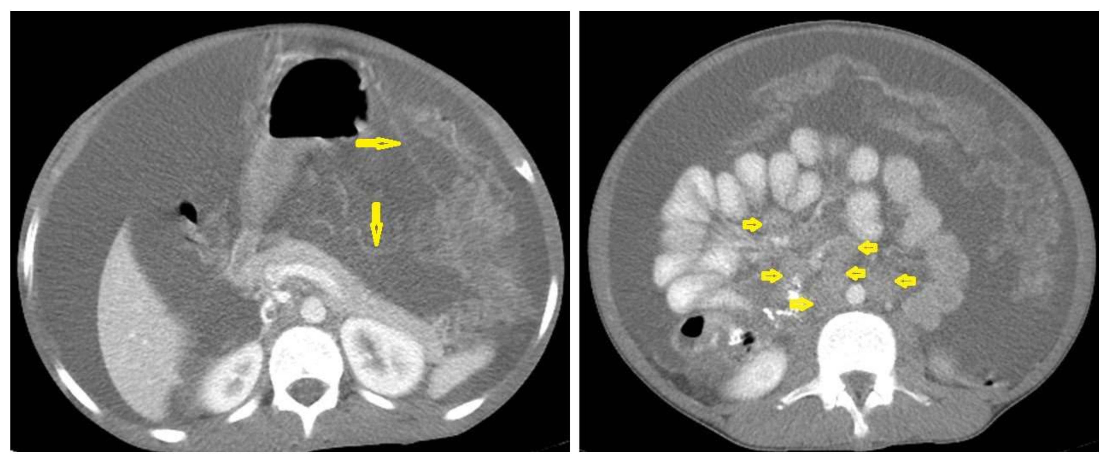 Diagnostics 12 00306 g021 550