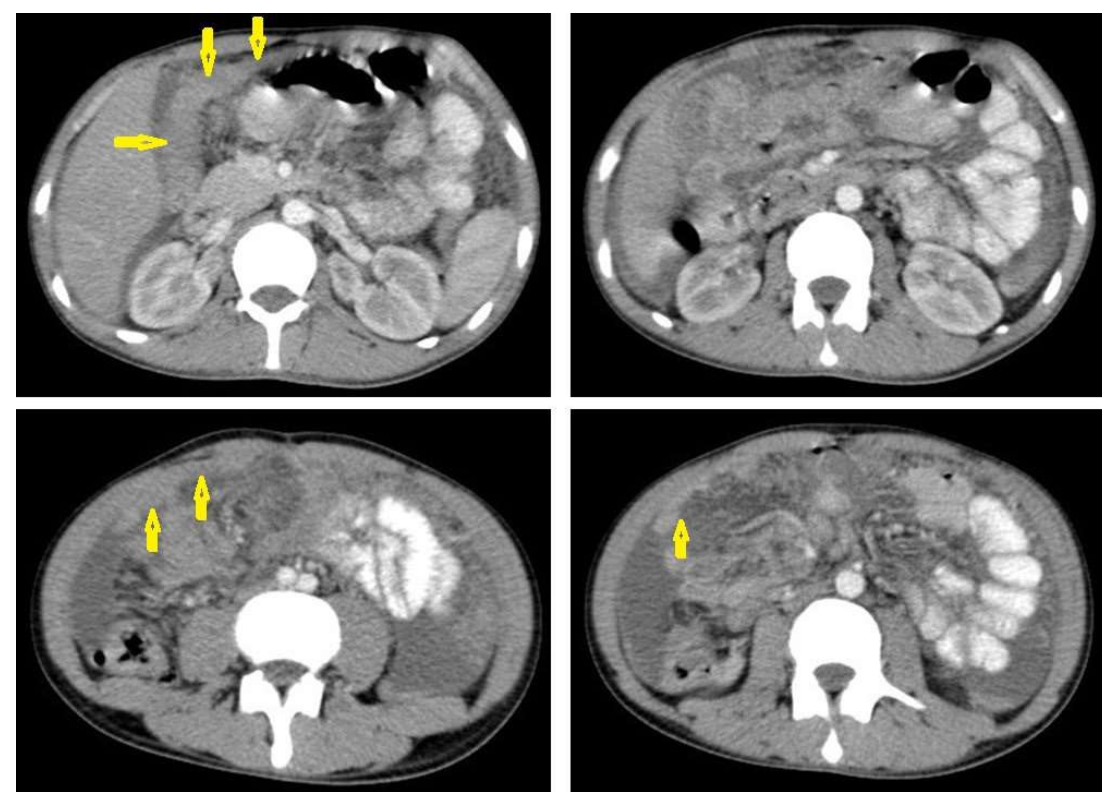 Diagnostics 12 00306 g022 550