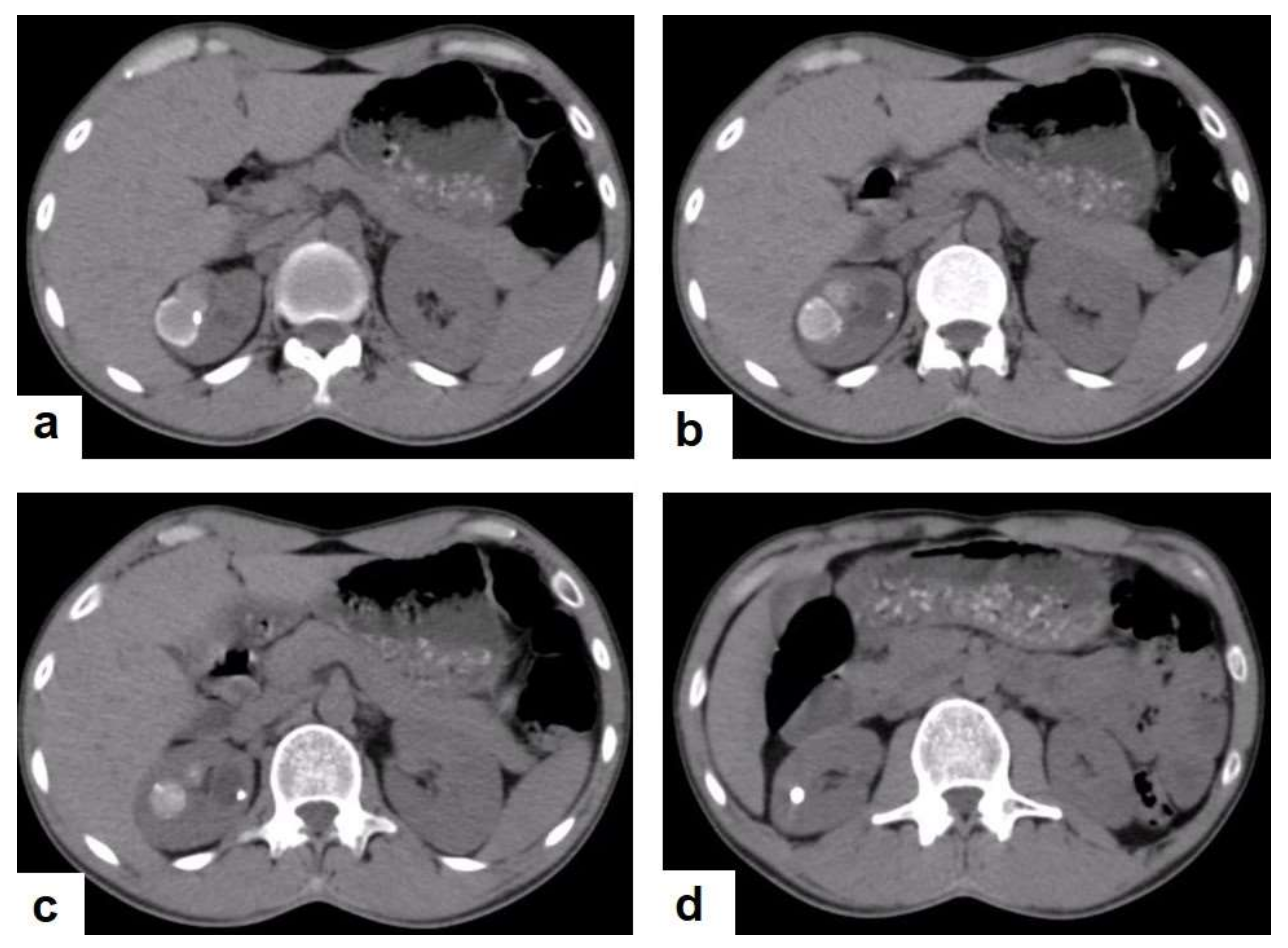 Diagnostics 12 00306 g023 550