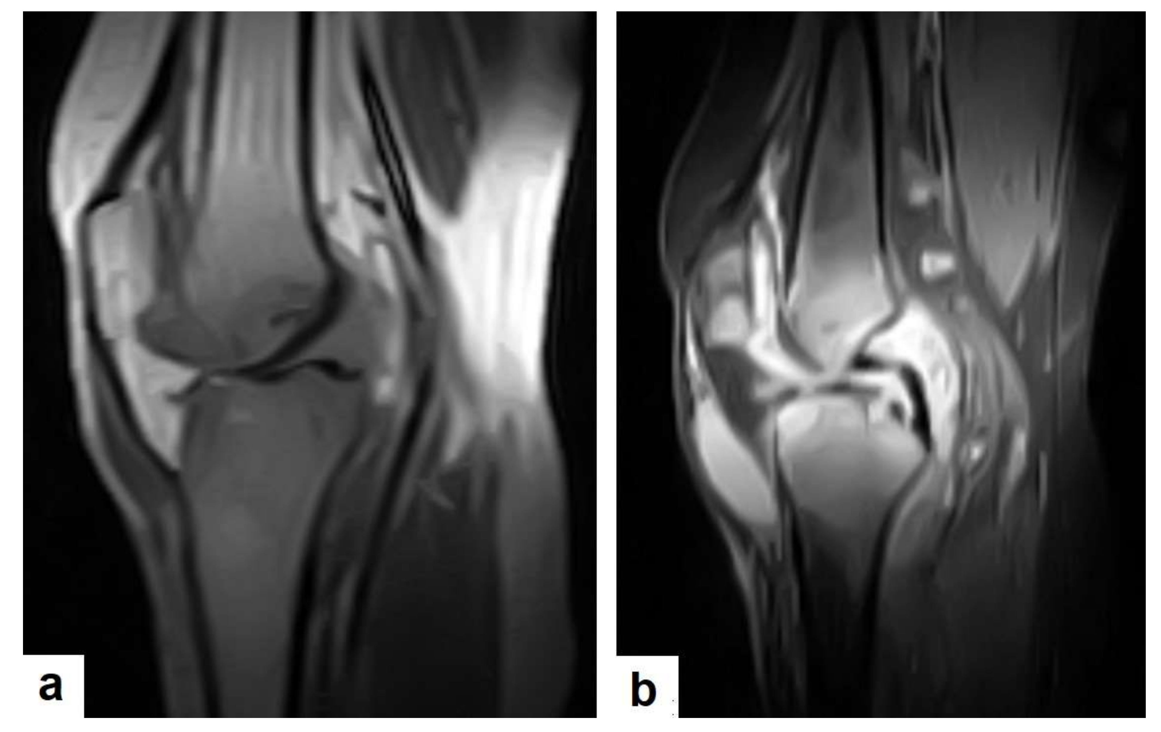 Diagnostics 12 00306 g024 550