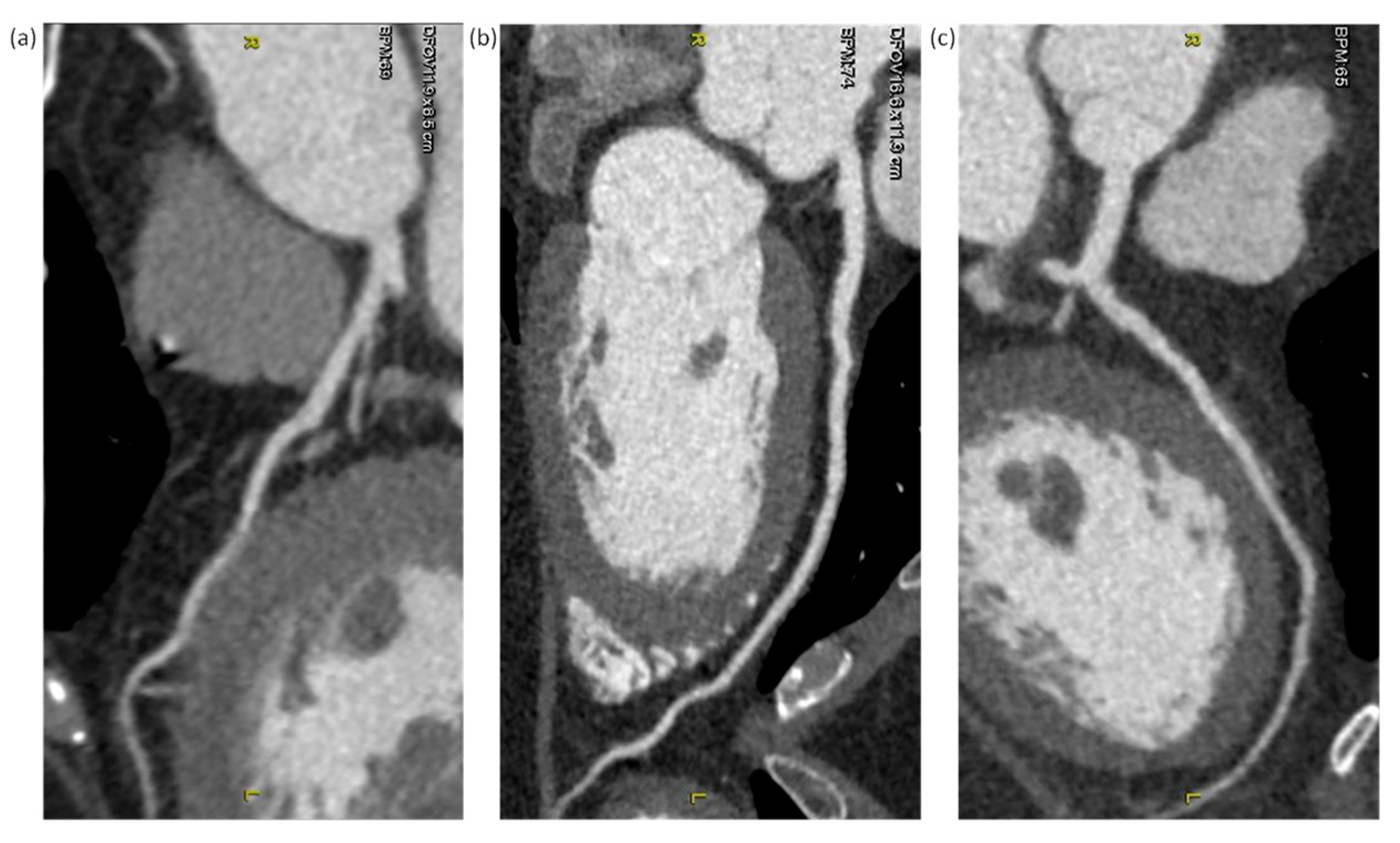 Diagnostics 12 00319 g006