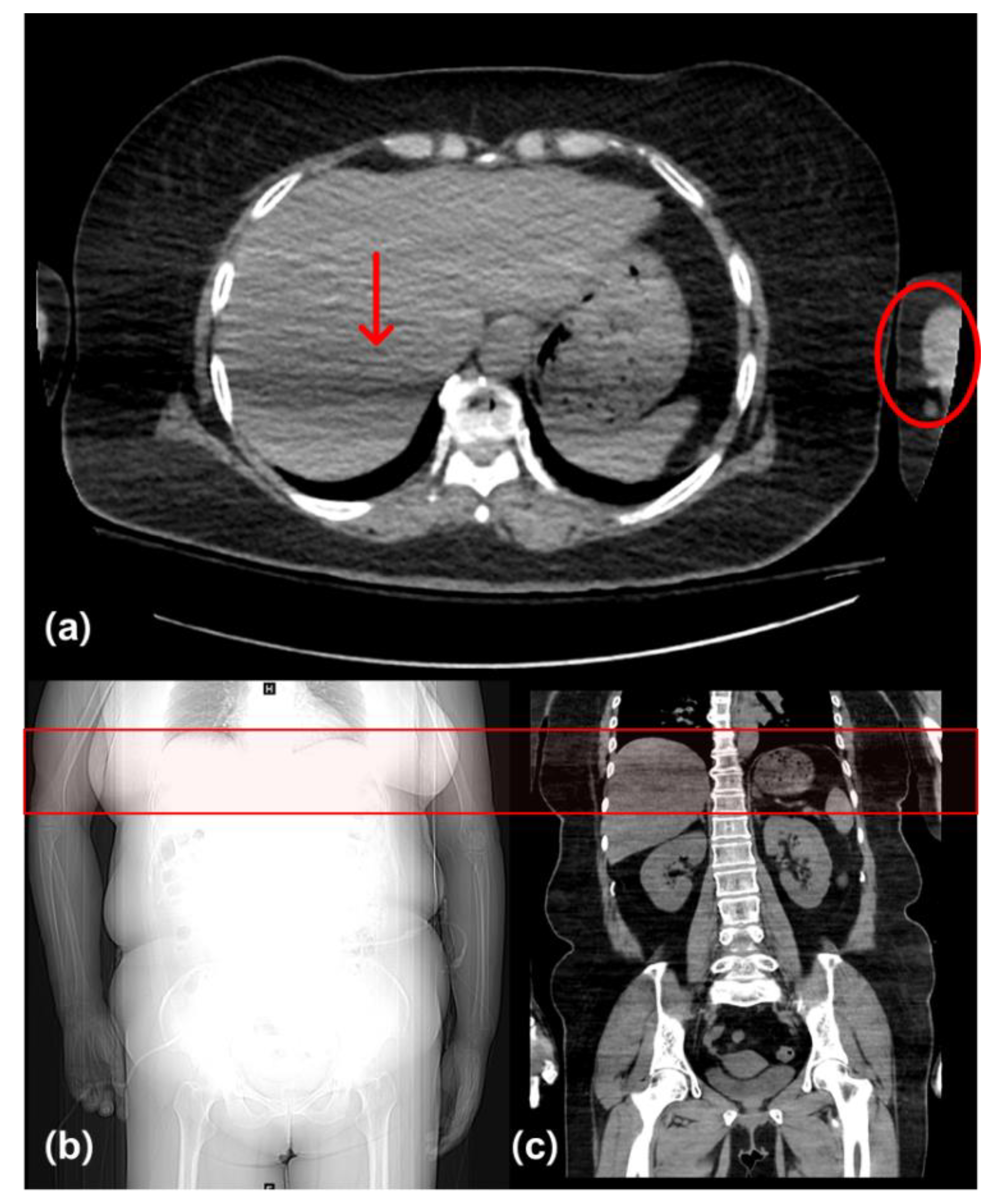 Diagnostics 12 00323 g004 550