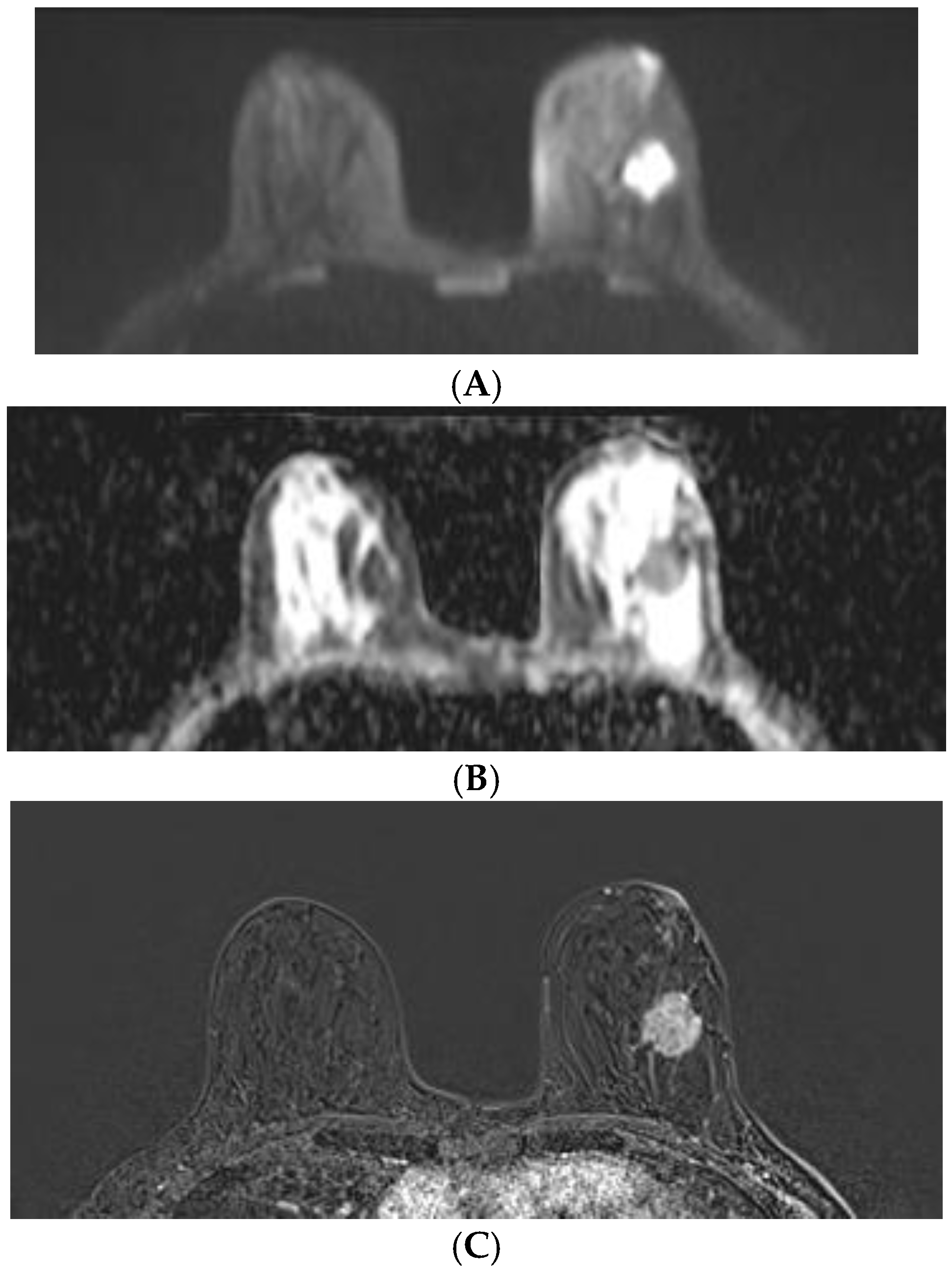 Diagnostics 12 00332 g005 550