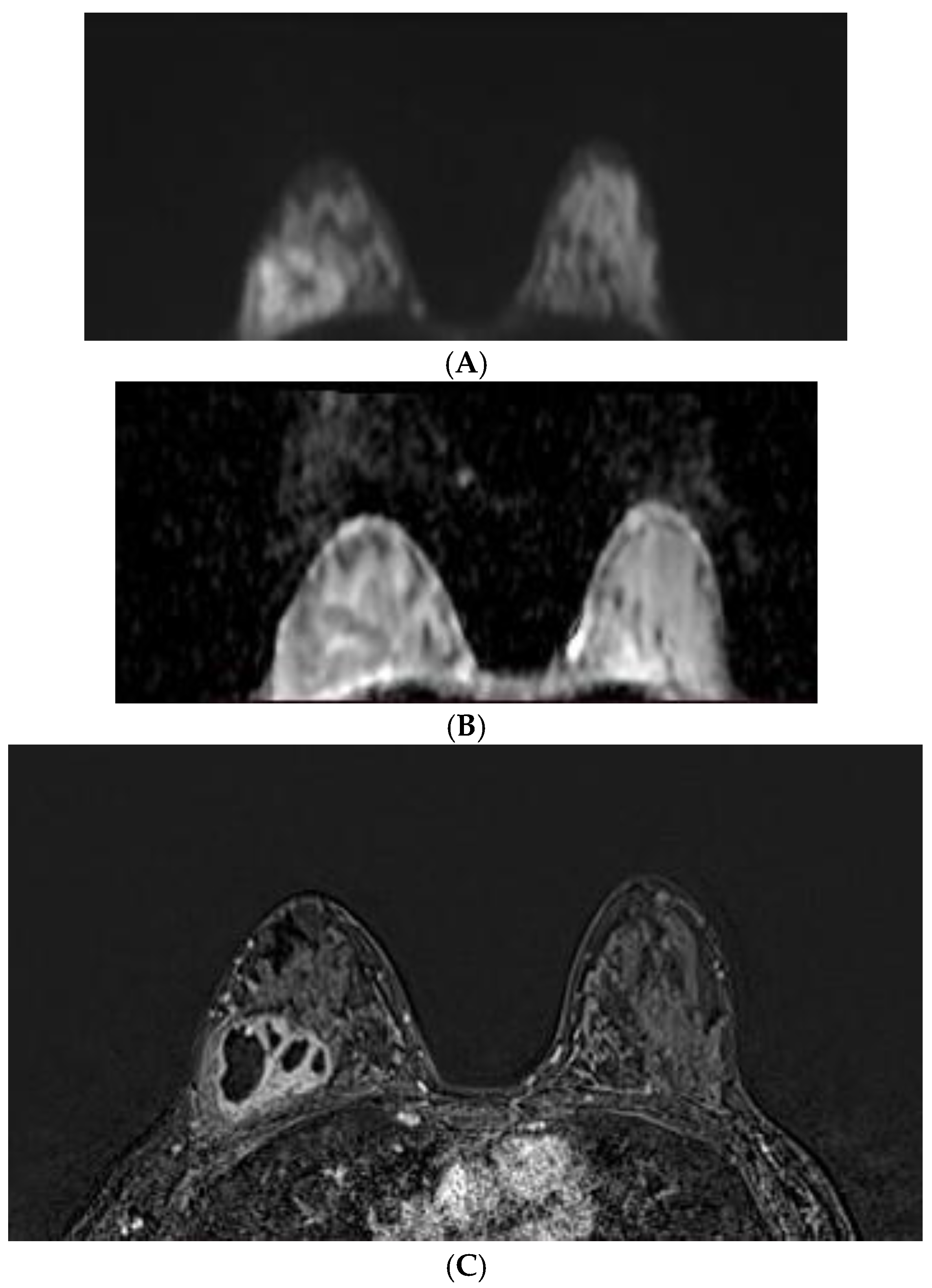 Diagnostics 12 00332 g006 550