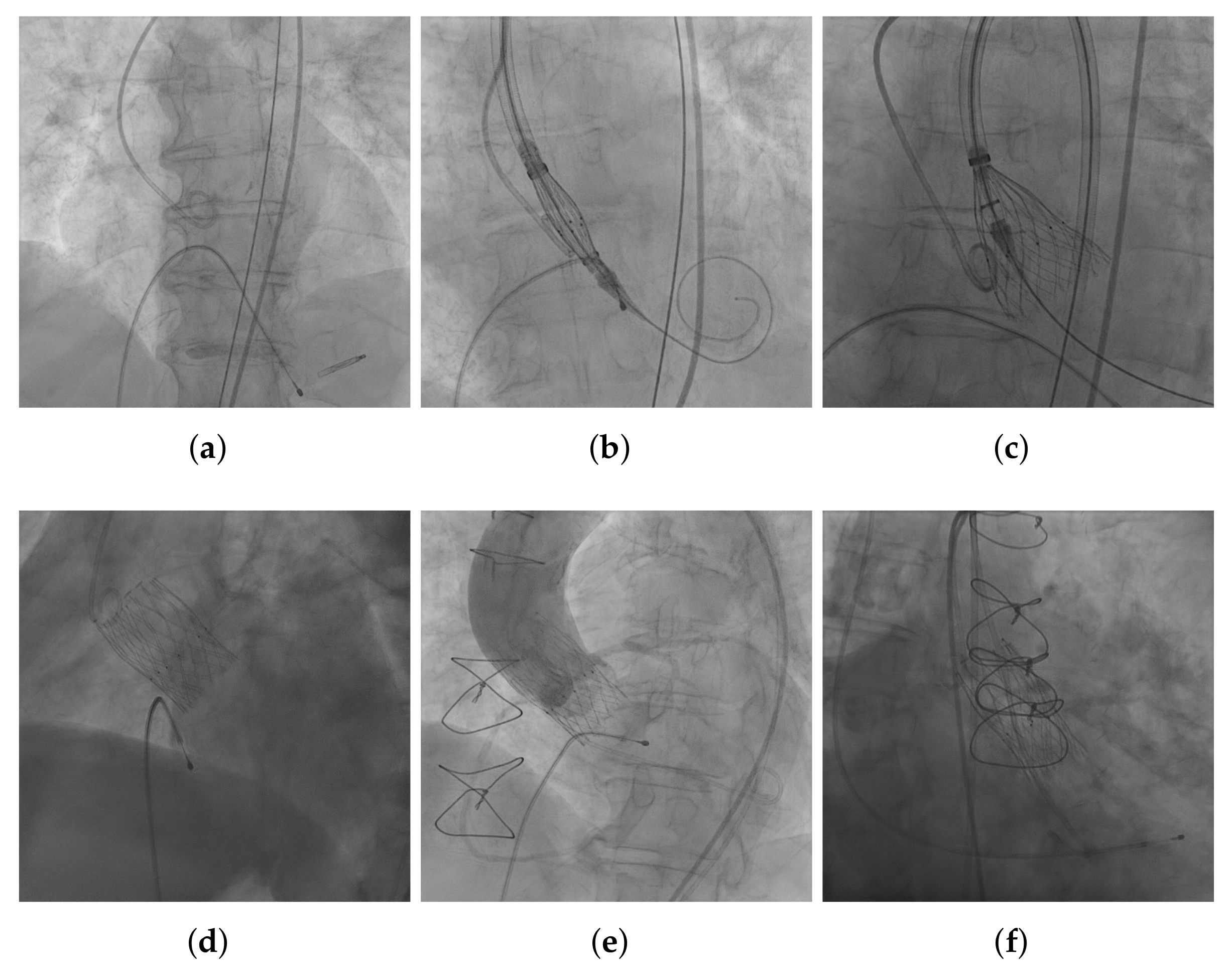 Diagnostics 12 00334 g002 550