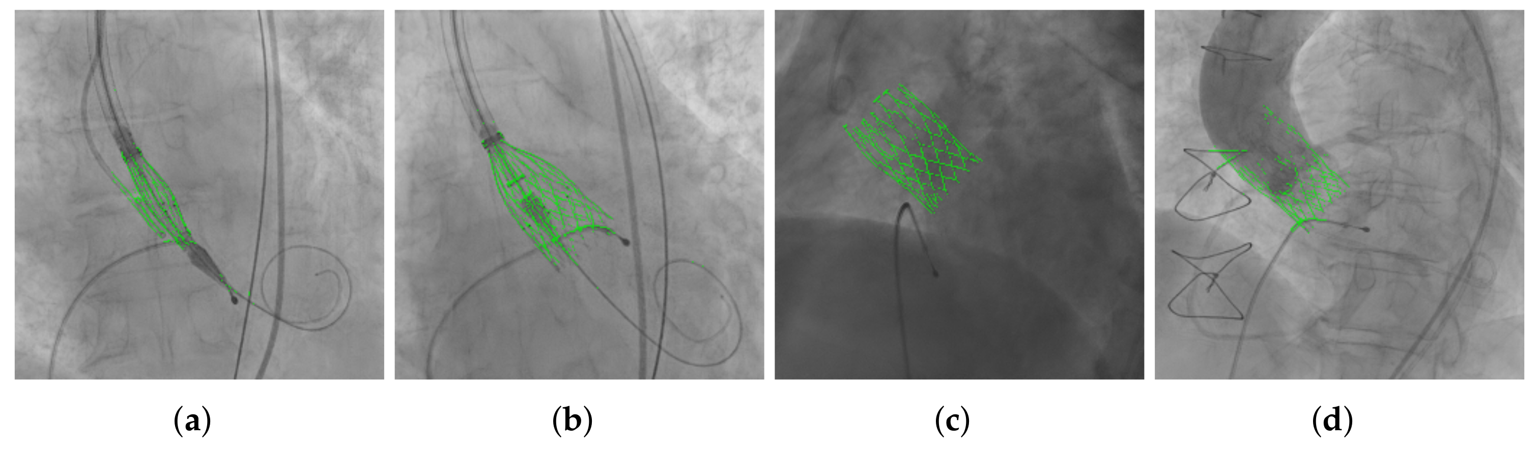 Diagnostics 12 00334 g004 550