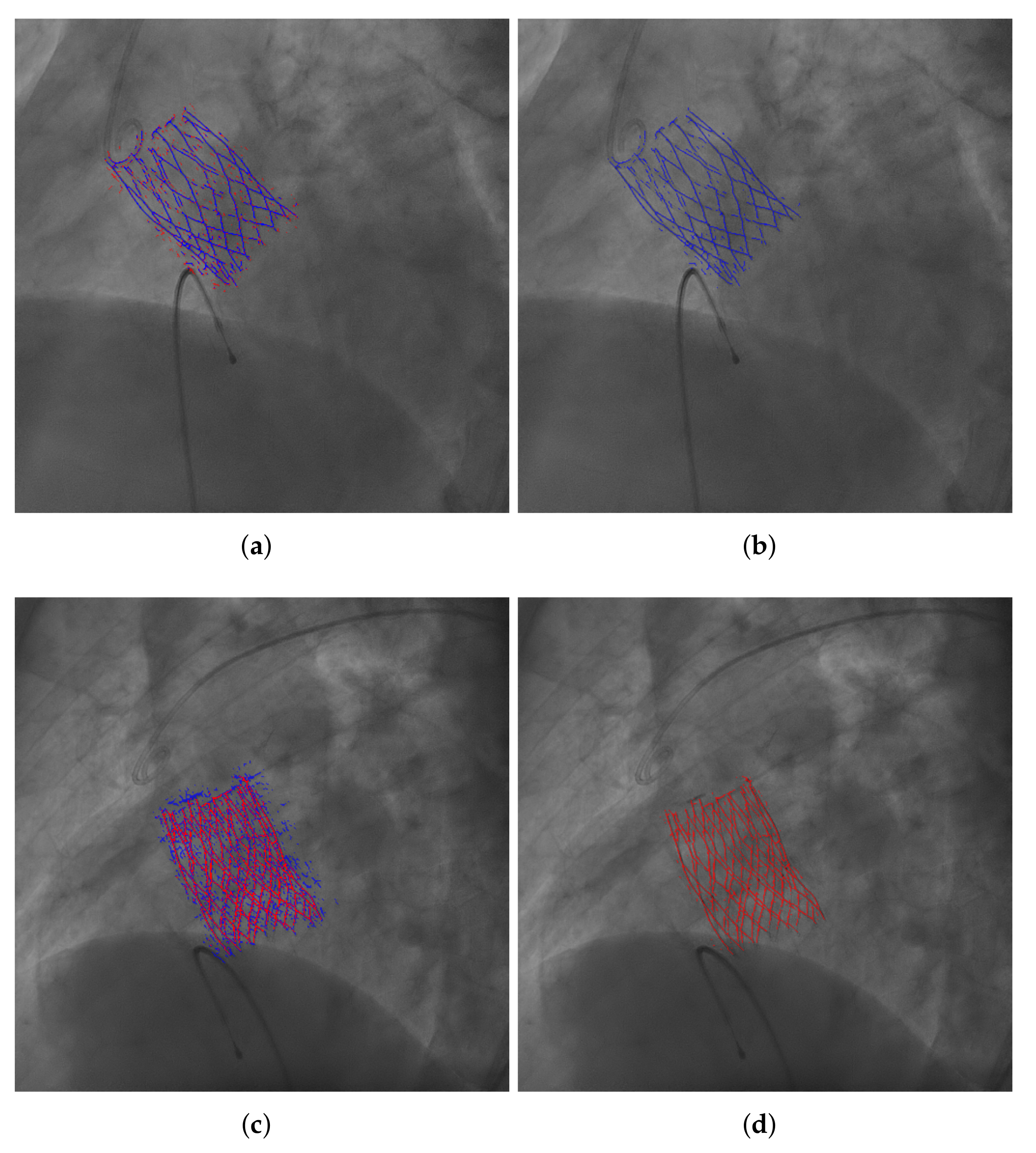 Diagnostics 12 00334 g007 550