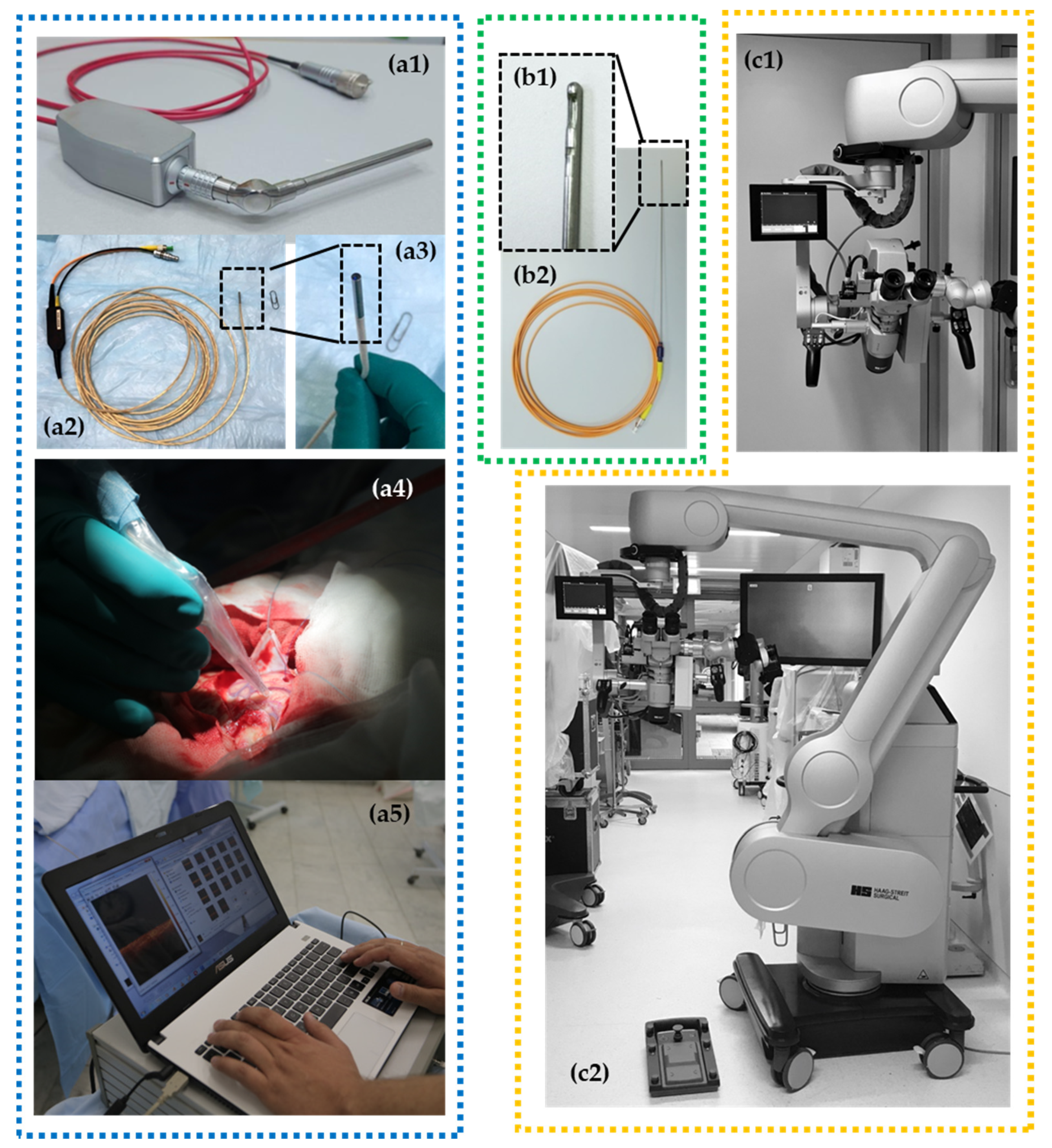 Diagnostics Free Full Text Oct Guided Surgery For Gliomas Current Concept And Future Perspectives Html