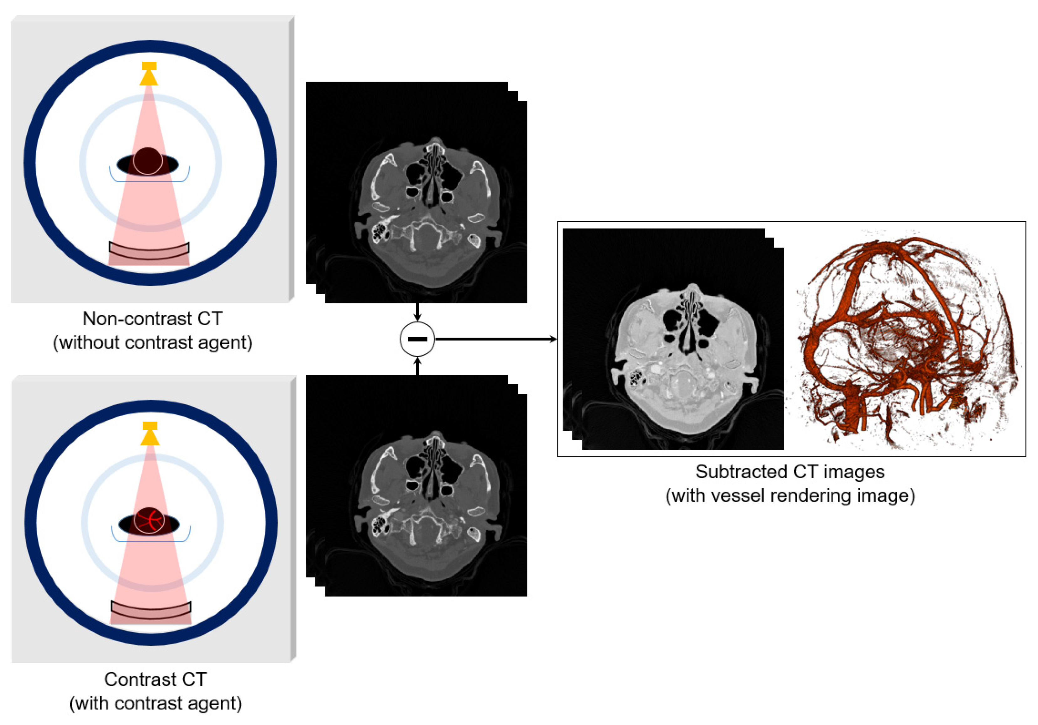 Diagnostics 12 00338 g001 550