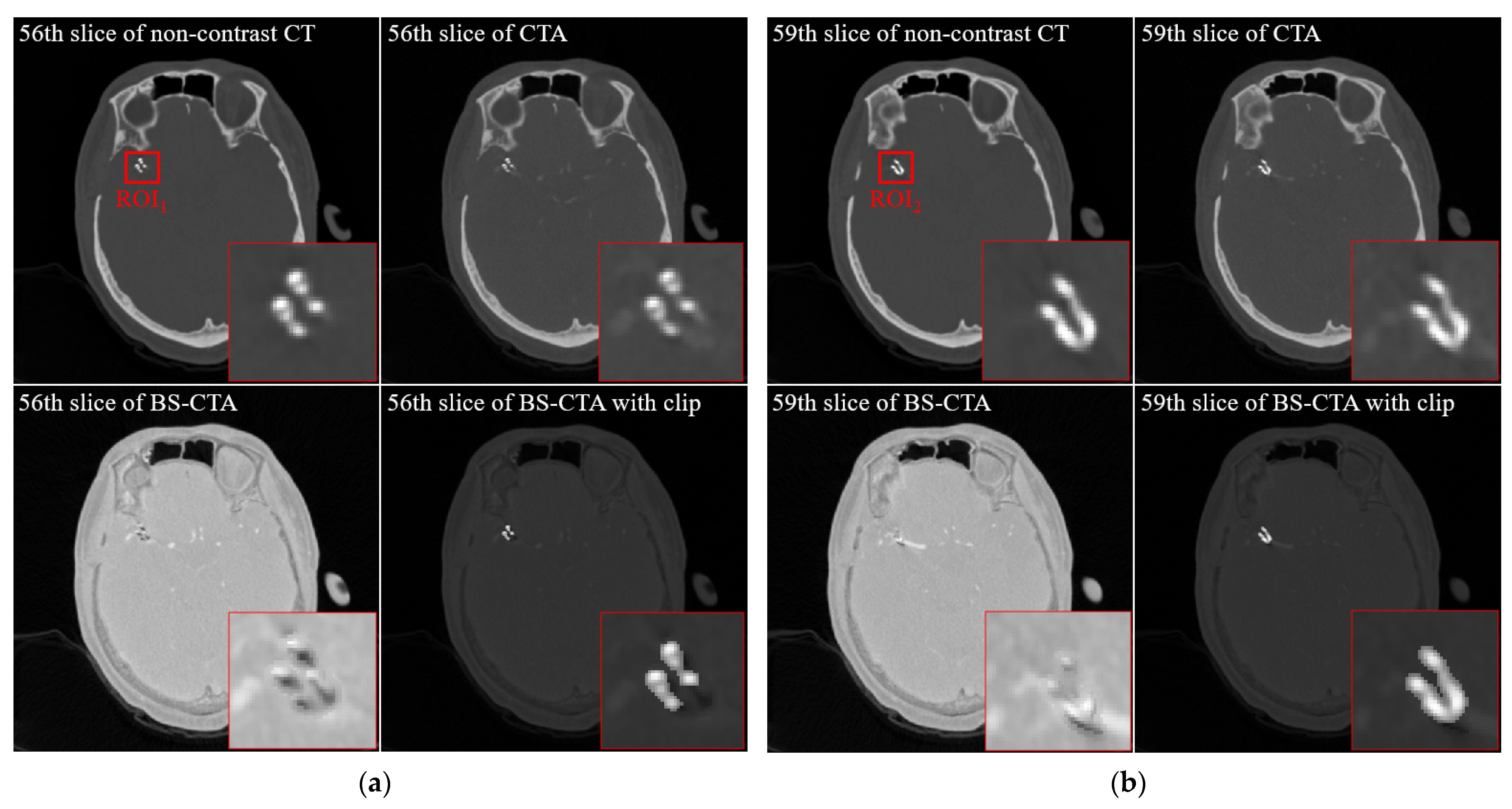 Diagnostics 12 00338 g004 550
