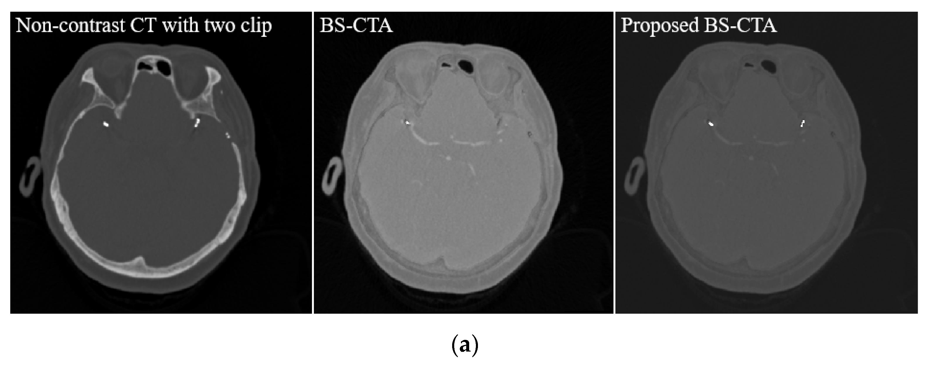 Diagnostics 12 00338 g007a 550