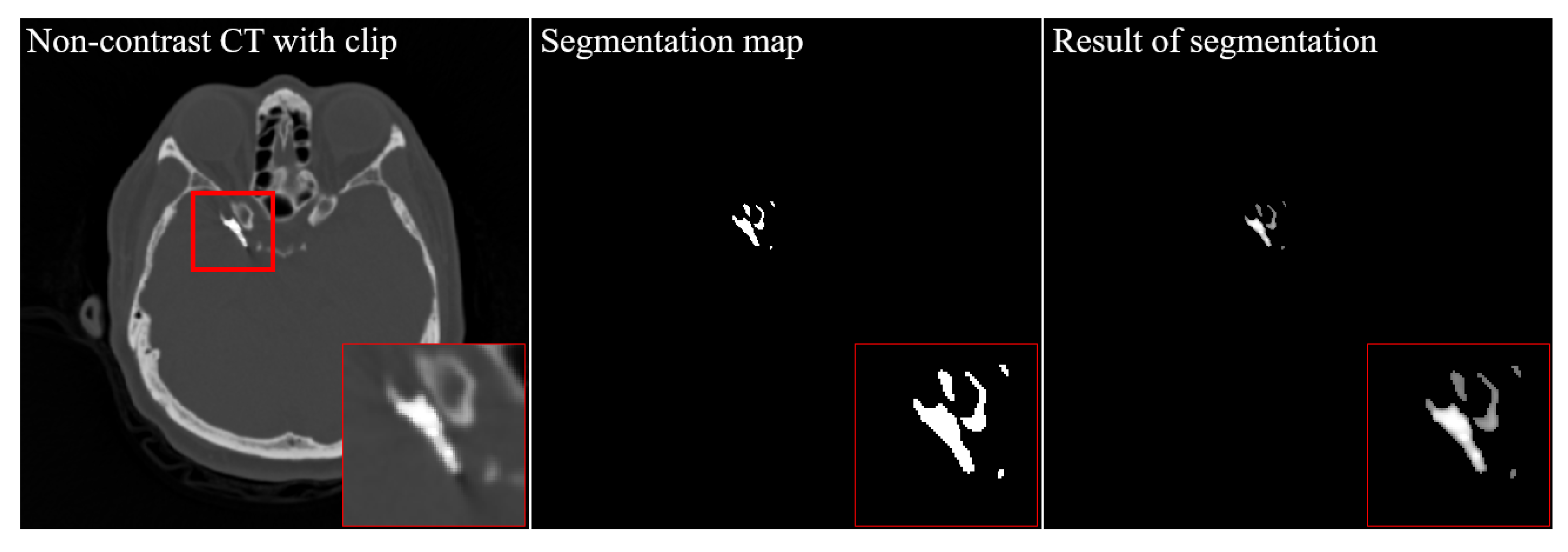 Diagnostics 12 00338 g009 550