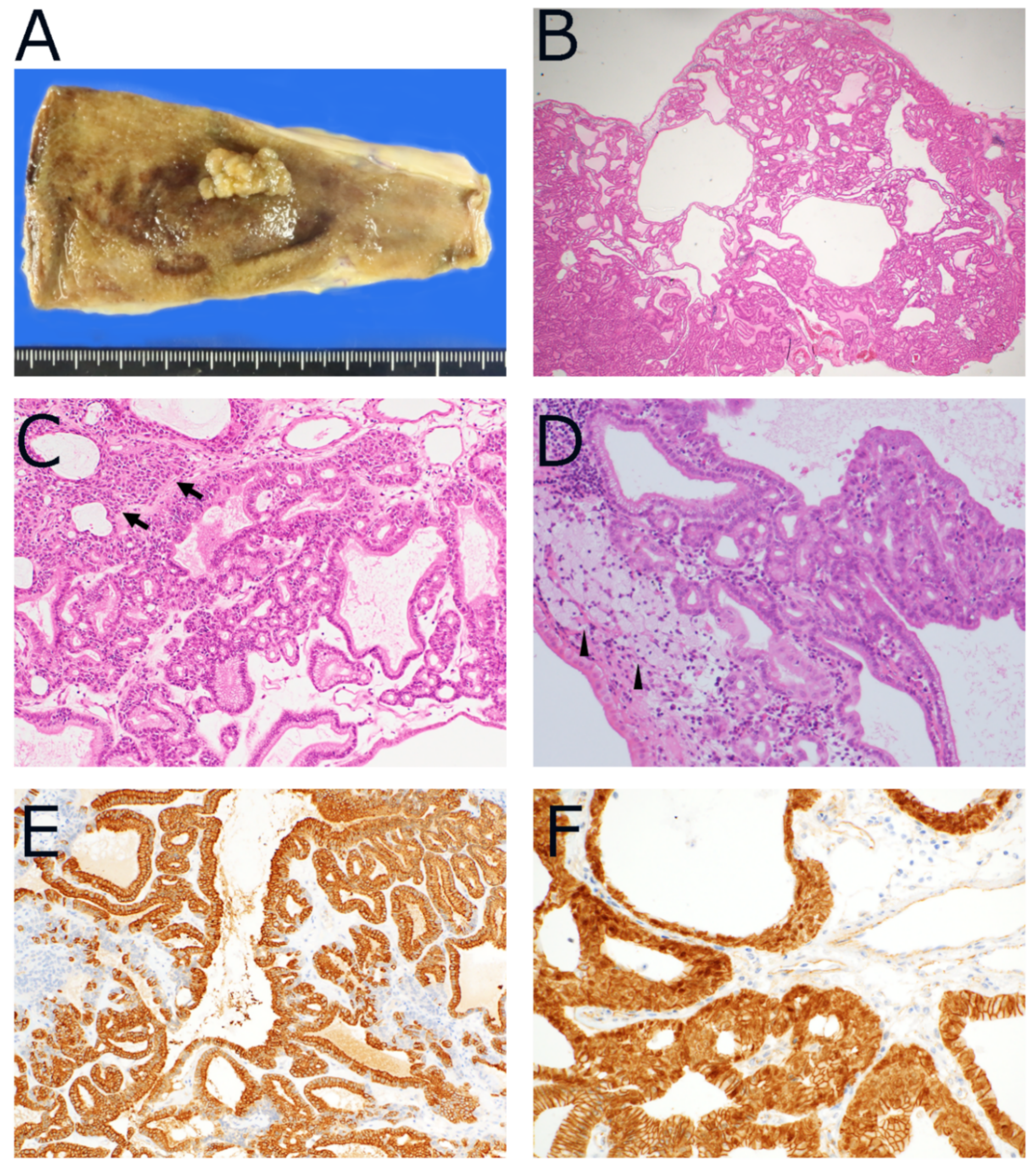 Diagnostics 12 00341 g001 Diagnostics 12 00341 g001