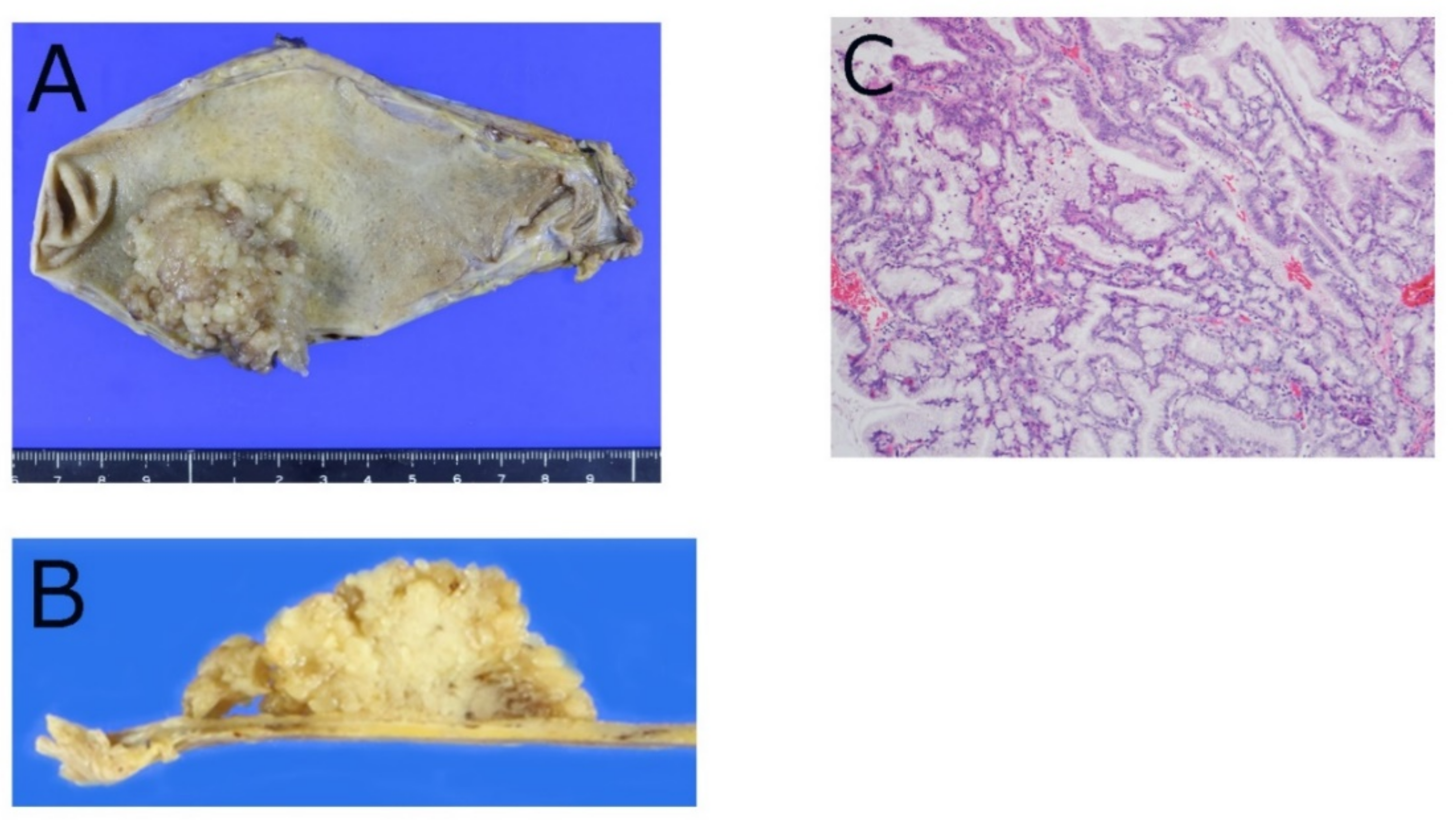 Diagnostics 12 00341 g002 Diagnostics 12 00341 g002