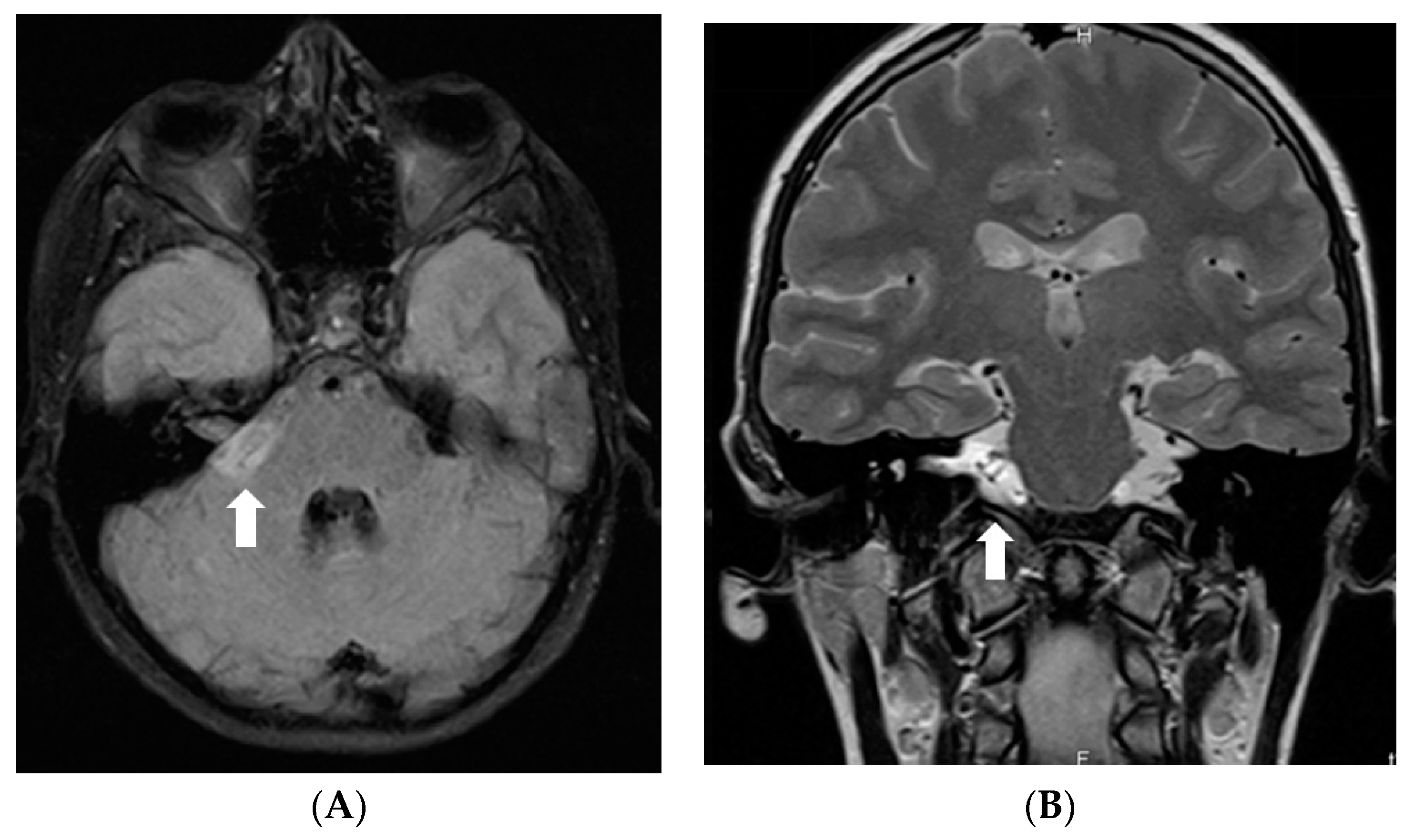 Diagnostics 12 00342 g001a 550