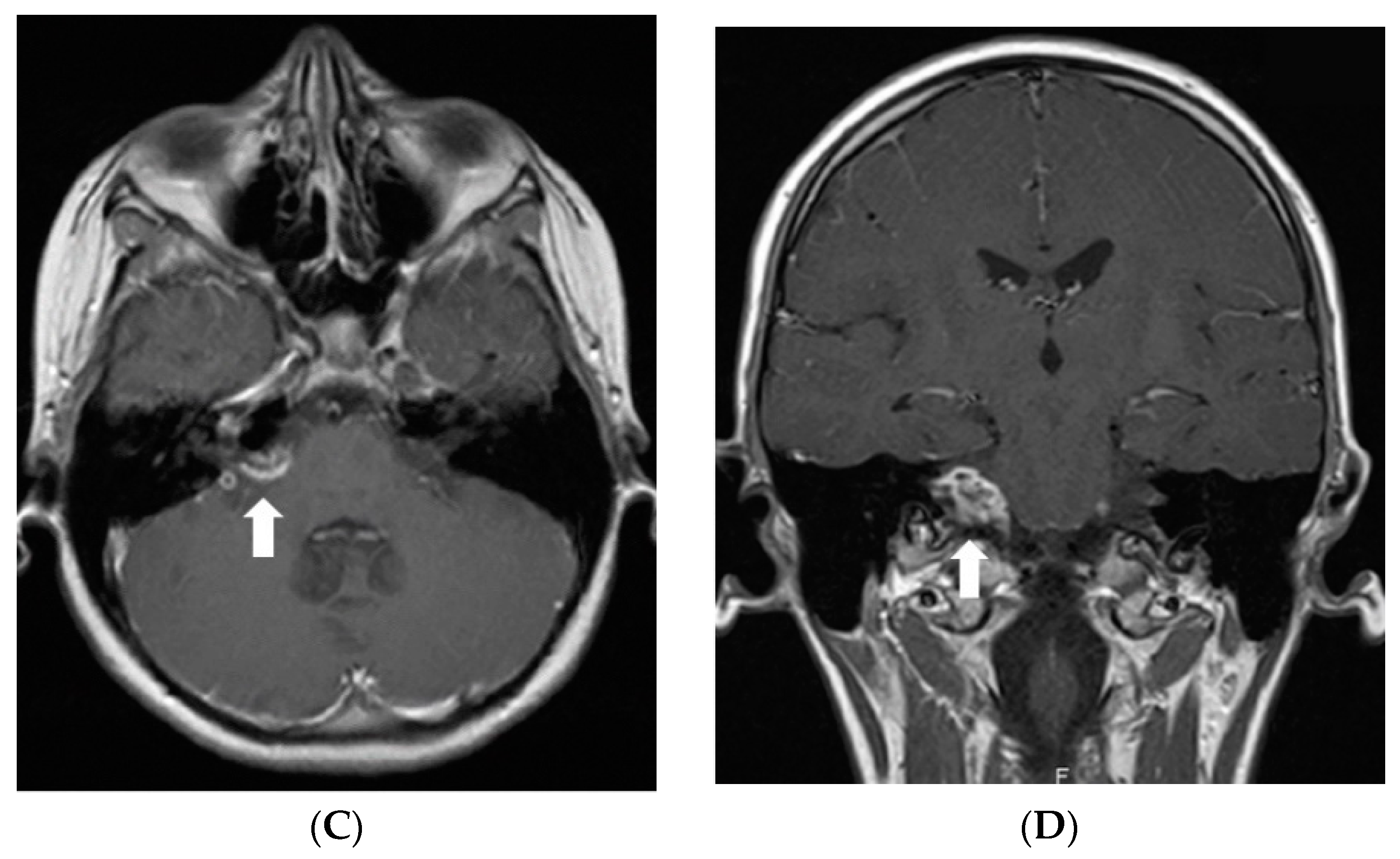Diagnostics 12 00342 g001b 550