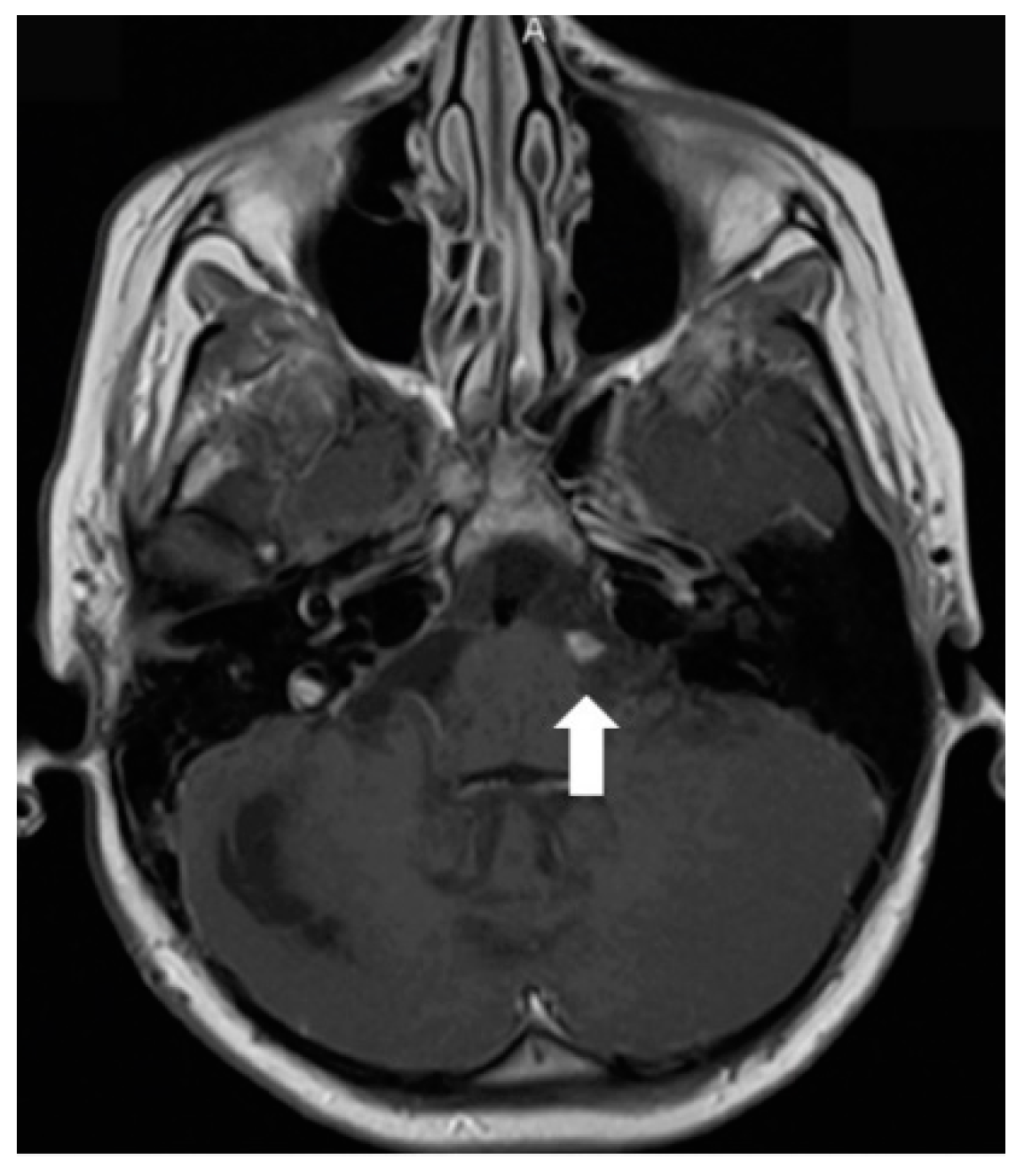 Diagnostics 12 00342 g002 550